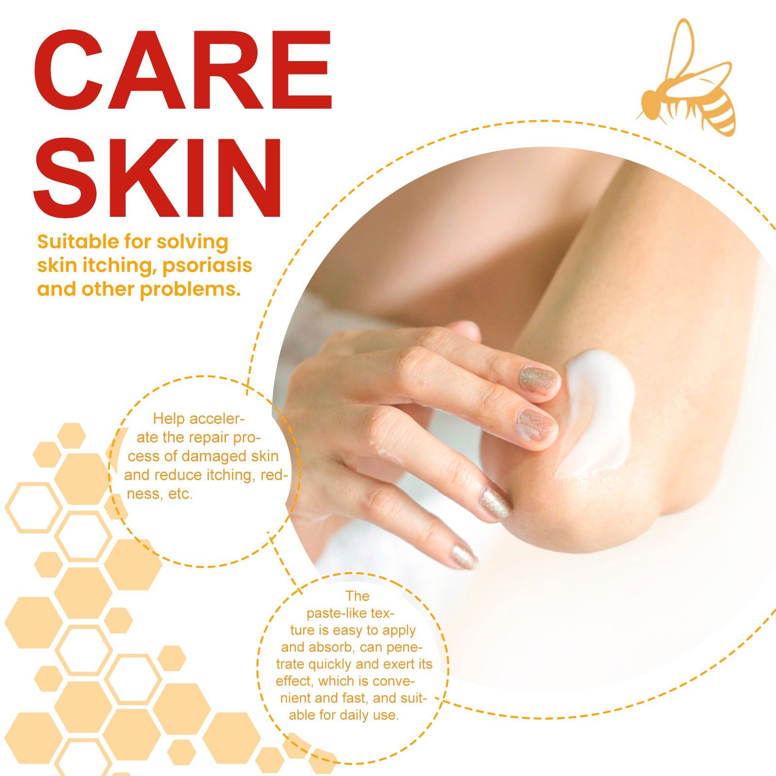 Bee-Poison Cowhide Moss Cream for Skin Care, Relieves Redness, Itchiness, Psoriasis ,20g