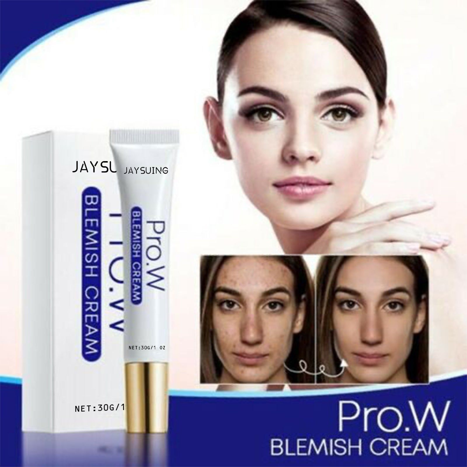Reduce Acne Marks Fast, Hydrating Spot Cream for Clear Skin, Gentle & Effective ,30g