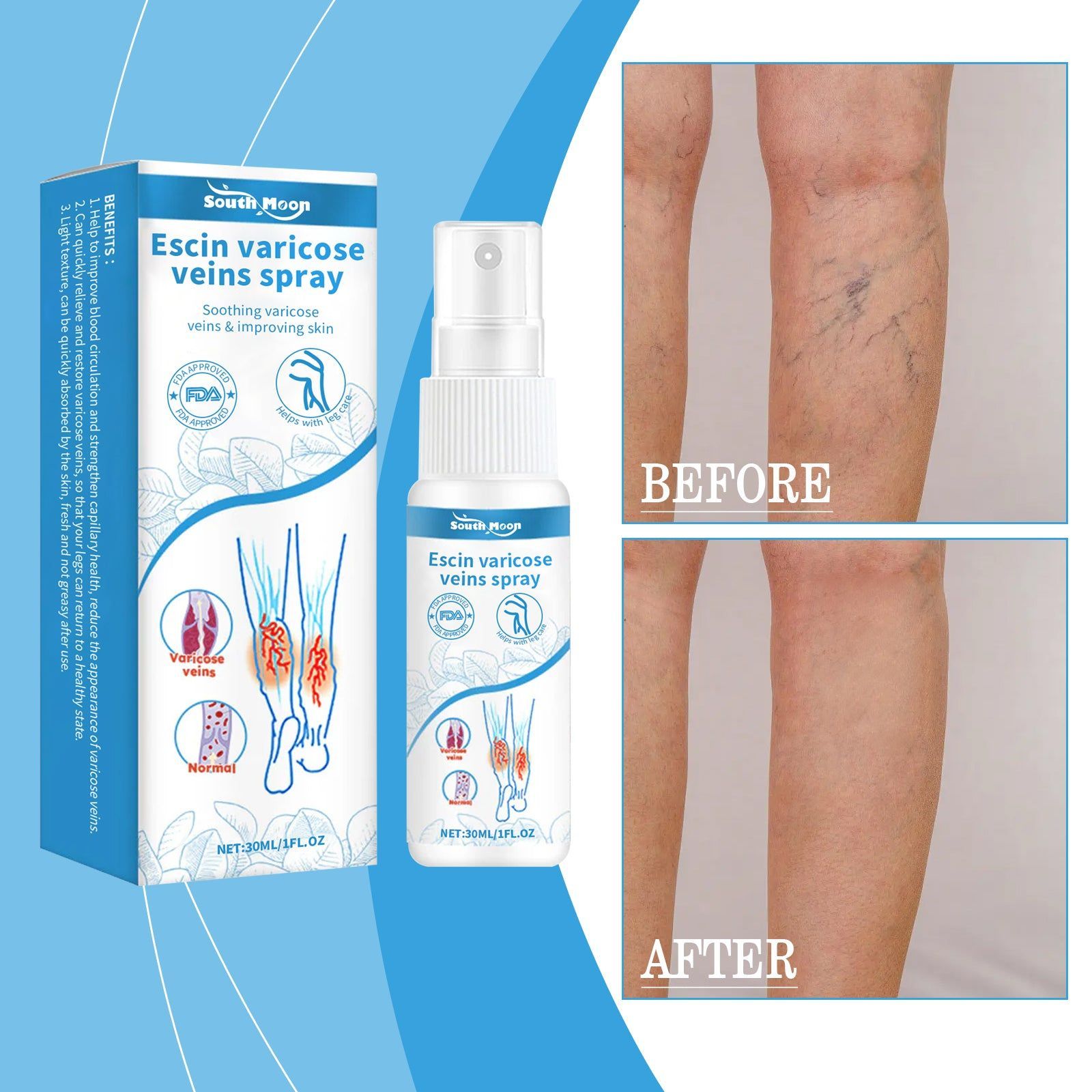Revitalize Your Legs with Vitamin C & Anthocyanins, Leg Care Spray for Varicose Veins ,30ml