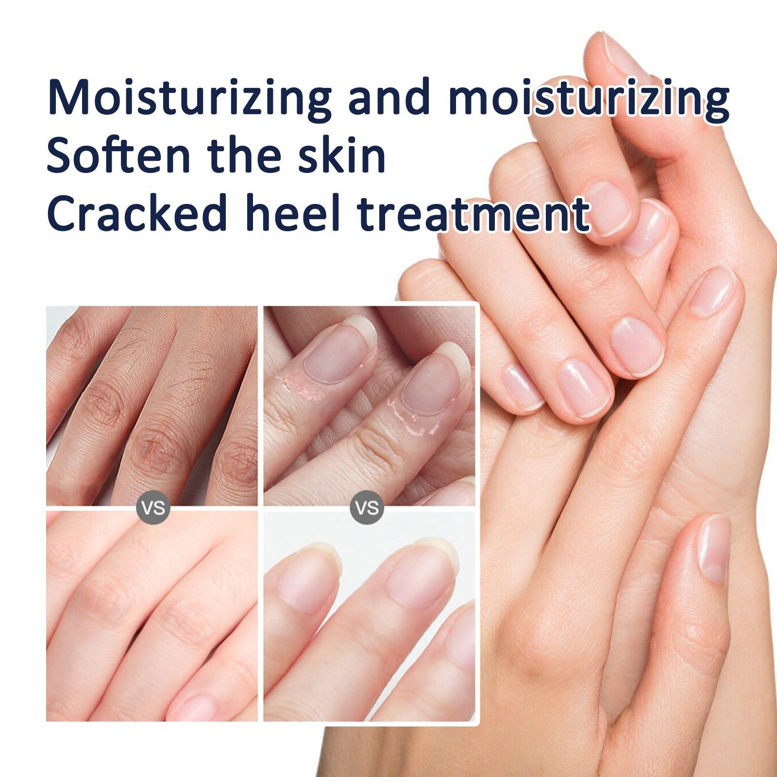 Anti-Crack Hand & Foot Cream, Deep Moisturizer, Softens Skin, Prevents Dryness ,30g