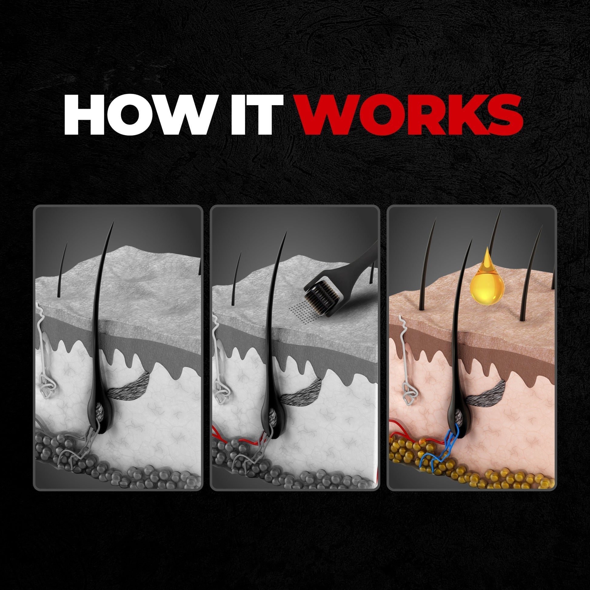 Beardo Dermaroller 0.5 mm