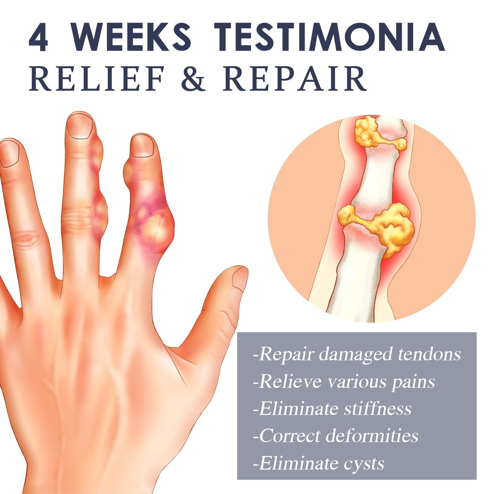 Relieve Joint Pain Naturally with Bee Venom Spray, Fast Pain Relief for Hands, Legs, Knees ,30ml