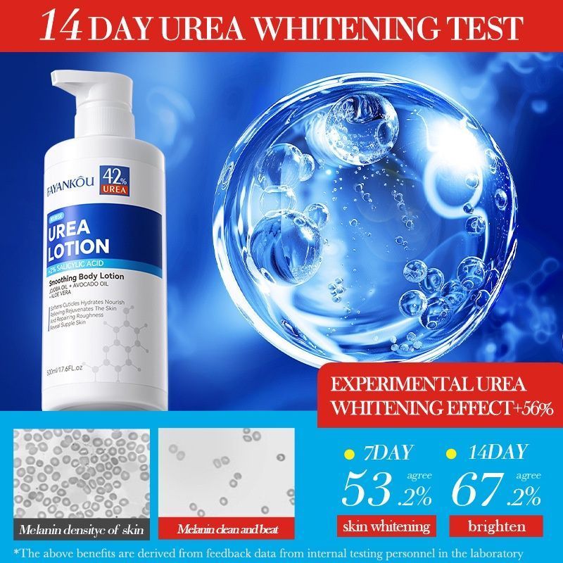 Urea moisturizing body lotion, moisturizes body skin-001-FYK40527