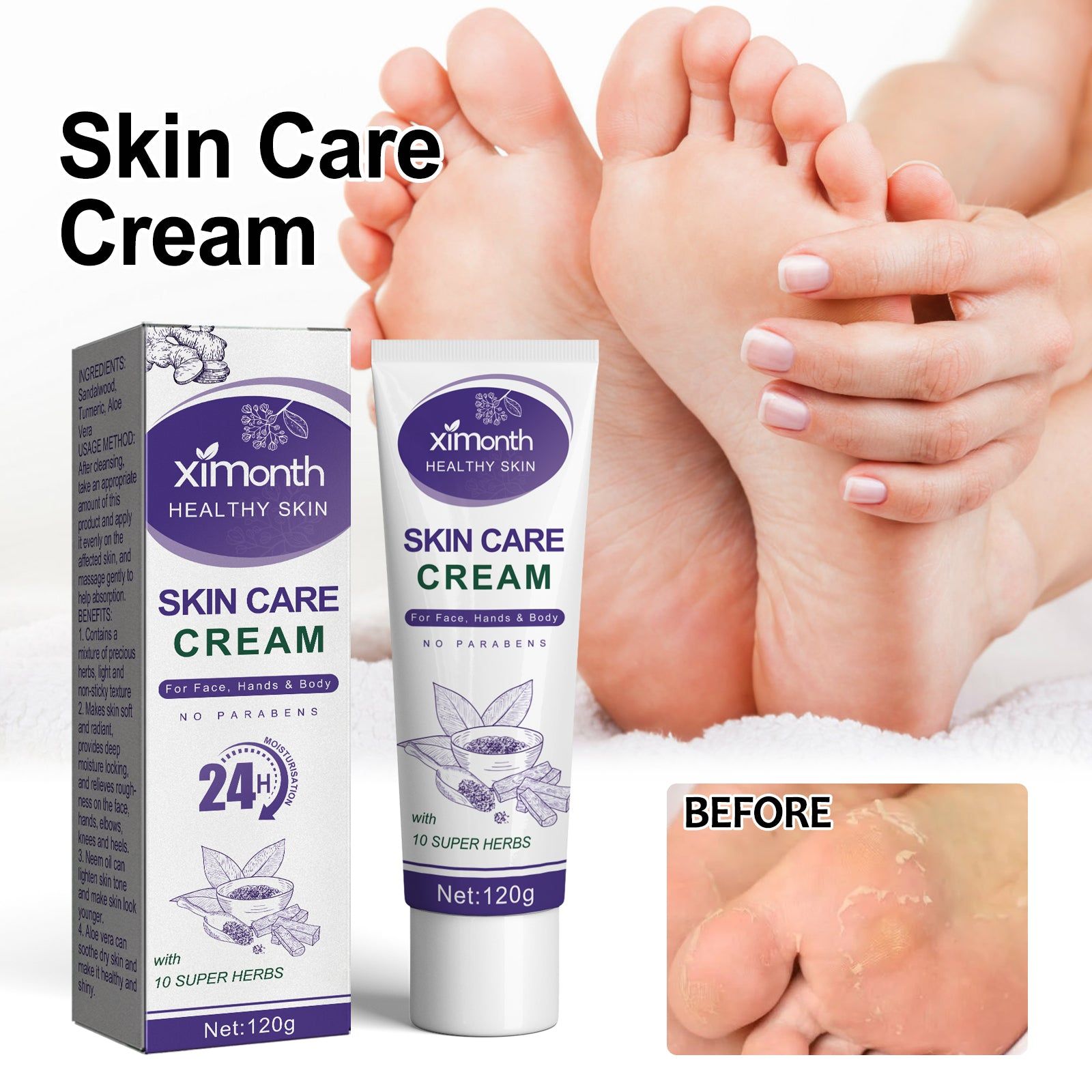 Anti-Crack Skin Care Cream, Deep Moisturizer for Soft, Smooth, Radiant Skin ,120g