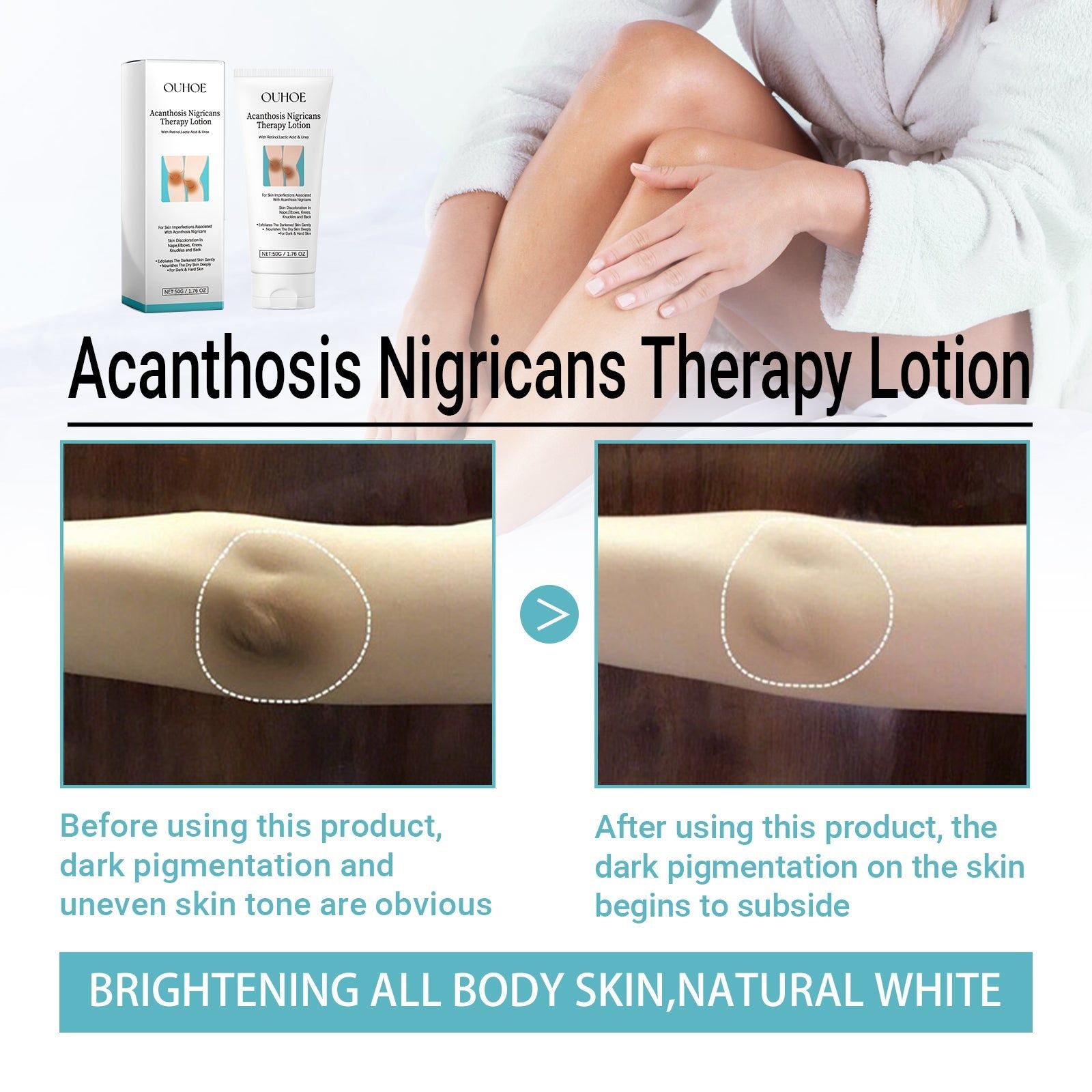 Revitalize Skin Care Lotion for Dark Spots, Acanthosis, Bright, Moisturize ,50g