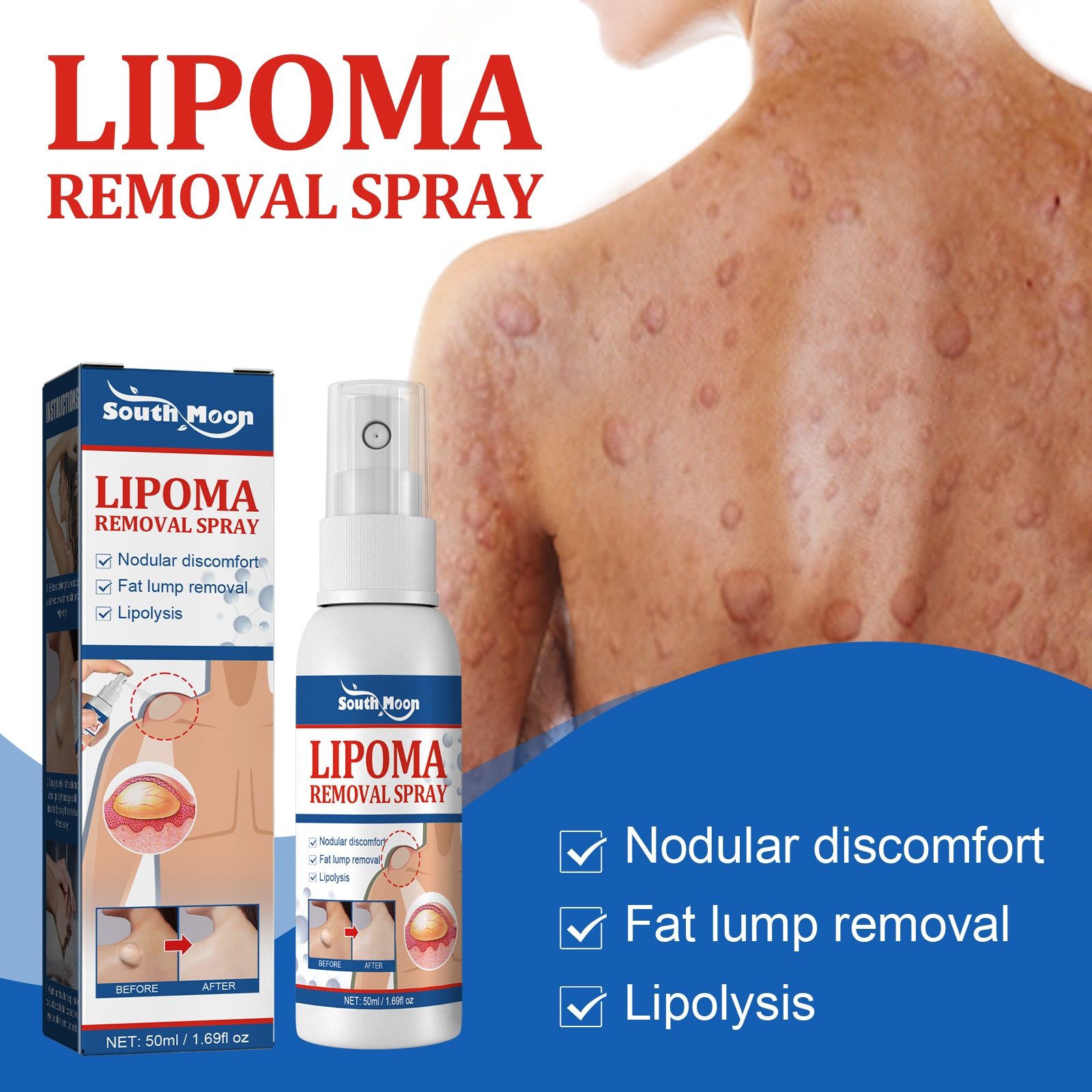 Body Care Spray, Skin Relief, Repair, Tightness & Discomfort, Lipoma Solution ,50ml