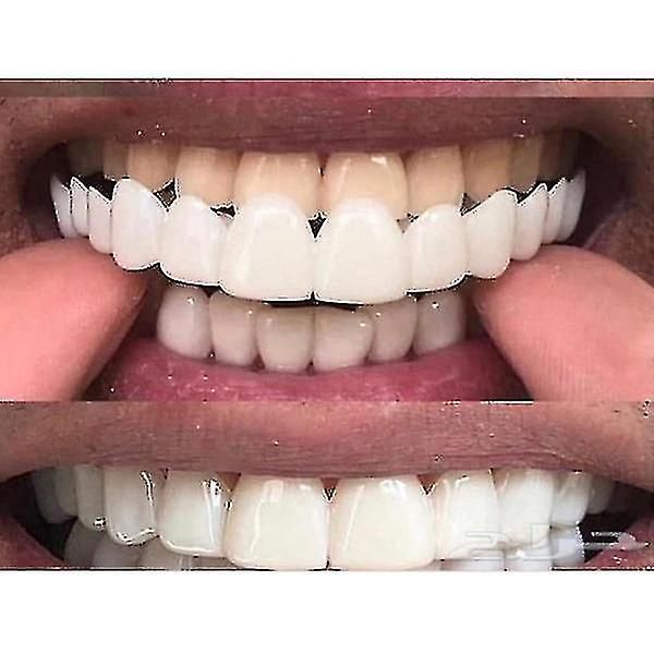 Upper/lower Comfort Fit Flex Whitening Denture Braces
