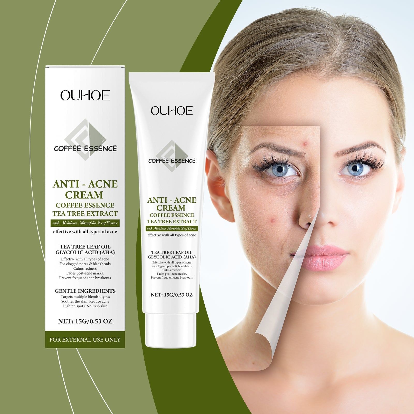 Acne Cleansing Nourishing Cream for Facial Care, Clear Pores, Hydrate, Lighten Acne-Prone Skin ,15g