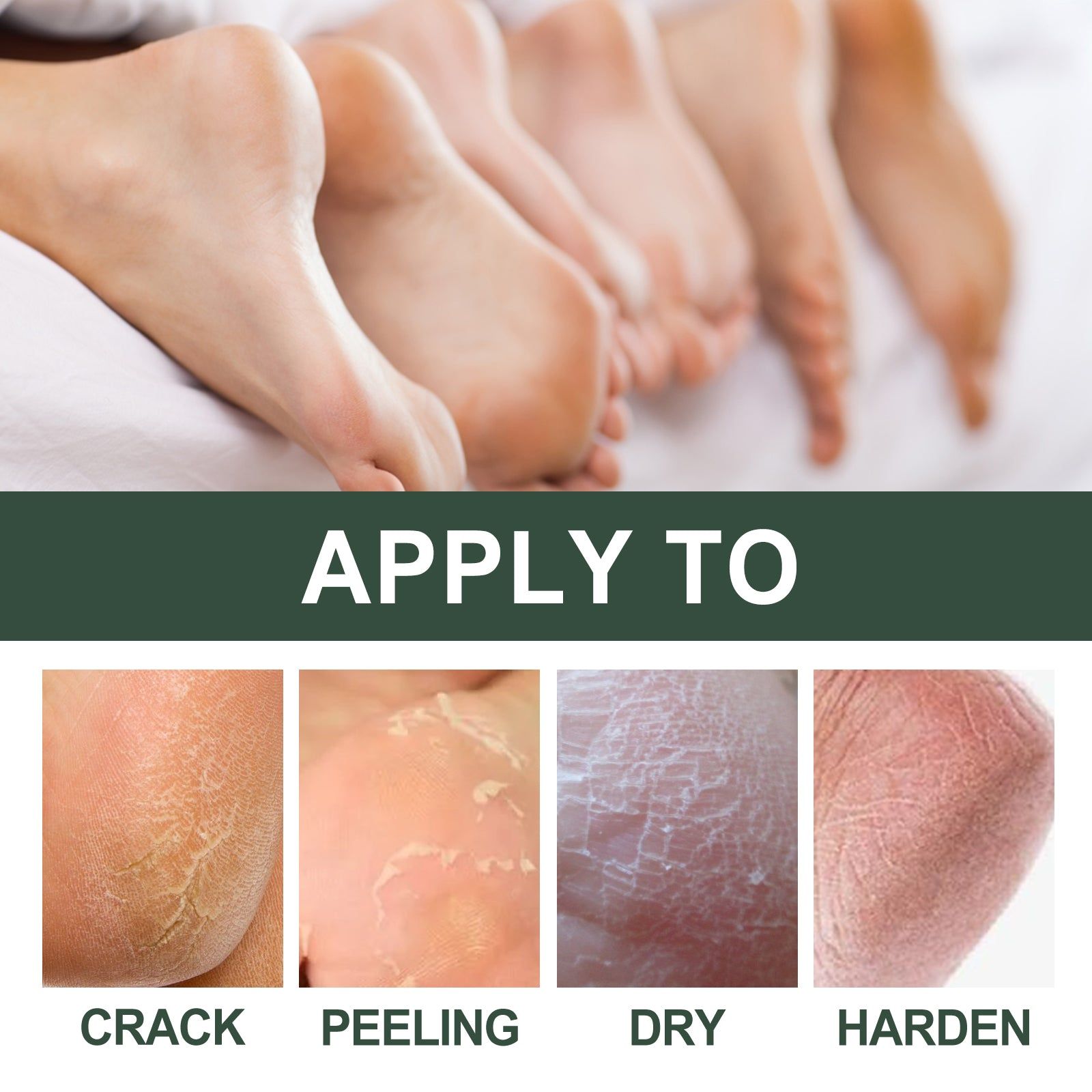 Ultimate Anti-Crack Hand and Foot Cream, Deep Moisturizer for Dry Skin, Repair & Nourish ,30g
