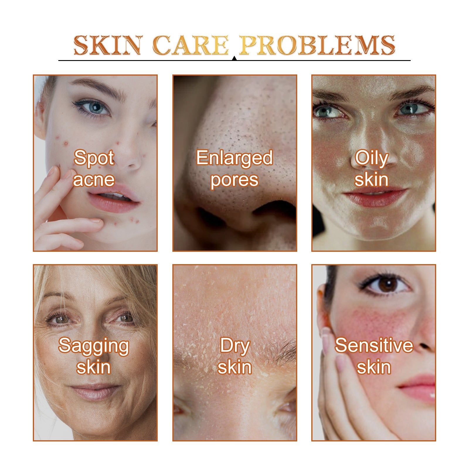 Brightening and Even Skin, Calendula Peel Mask for Clear Pores, Oil Control, Glow ,60g