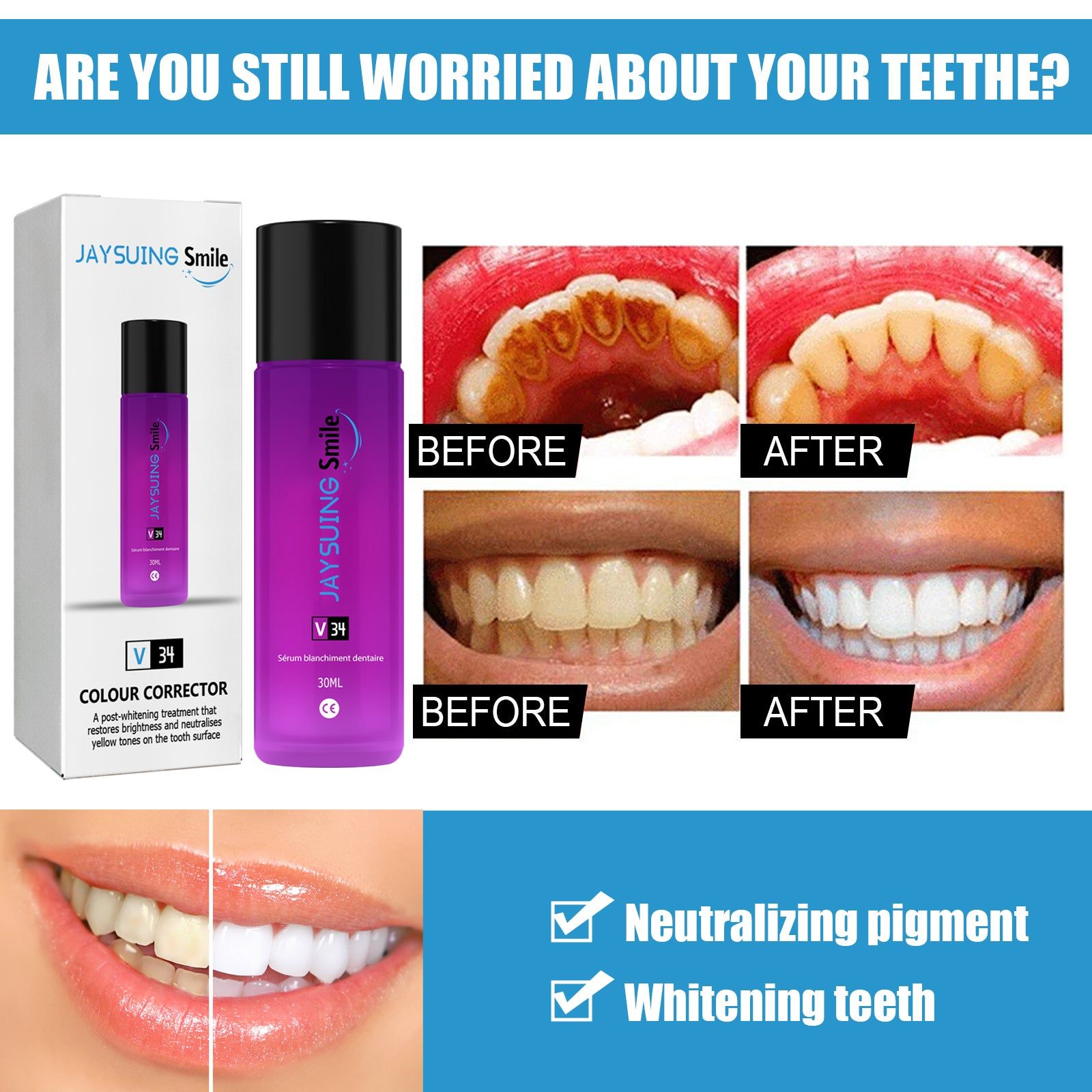 Brighten and Whiten Teeth, Neutralize Yellow Pigments, Fast Teeth Whitening Serum ,30ml