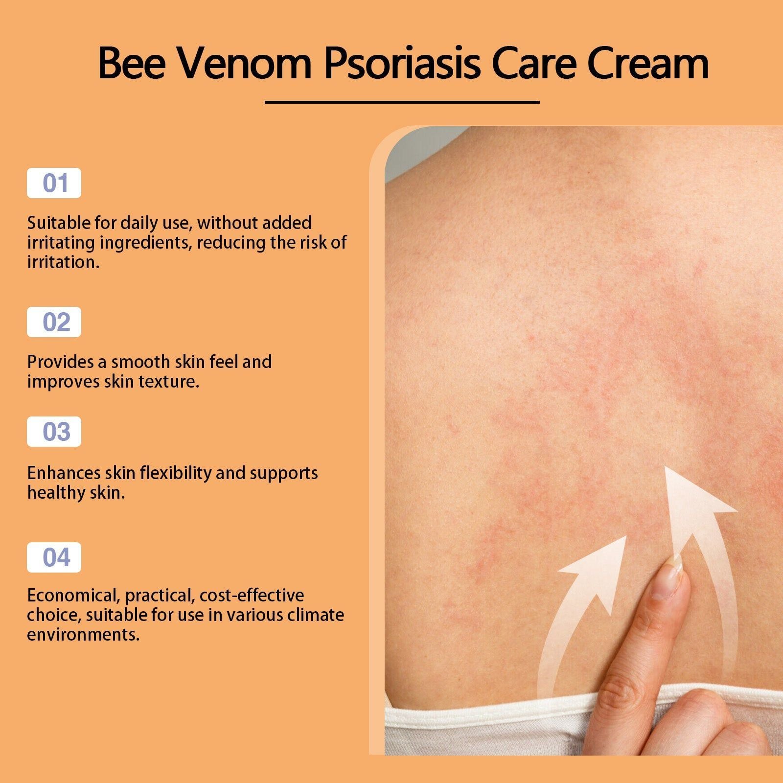 Bee-Venom Moss Care Cream for Skin Repair, Moisturizes, Soothes Itchy Red Hands and Feet ,20g