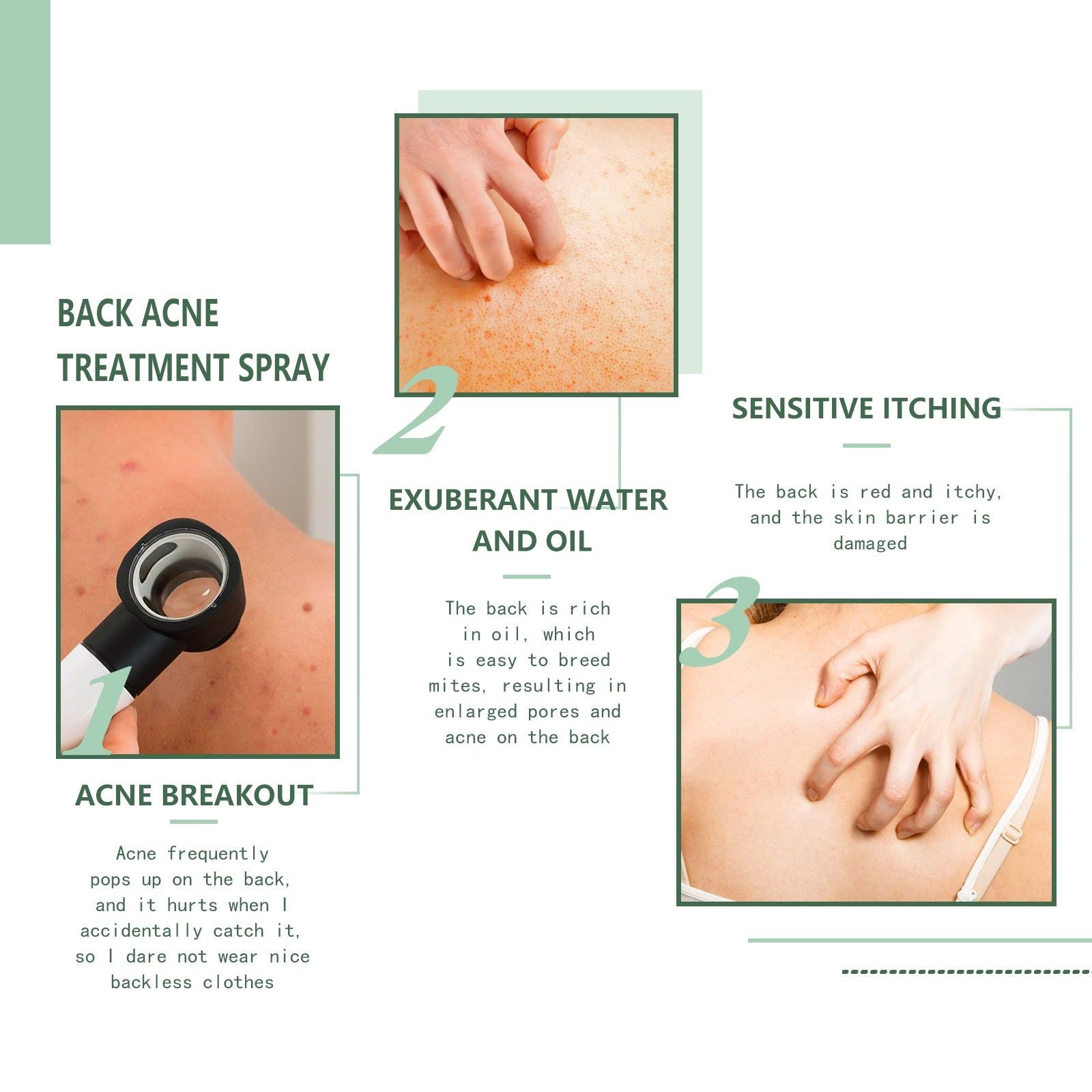 Body Care Spray, Gentle Acne & Moisturizing Mist, Skin Repair, Hydrating, Clear Skin ,120ml