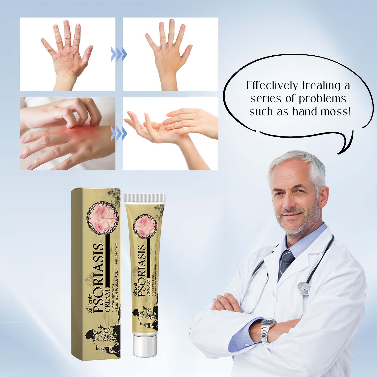 Breaking Itch King Psoriasis Cream, Fast Relief for Red, Itchy, and Irritated Skin ,20g
