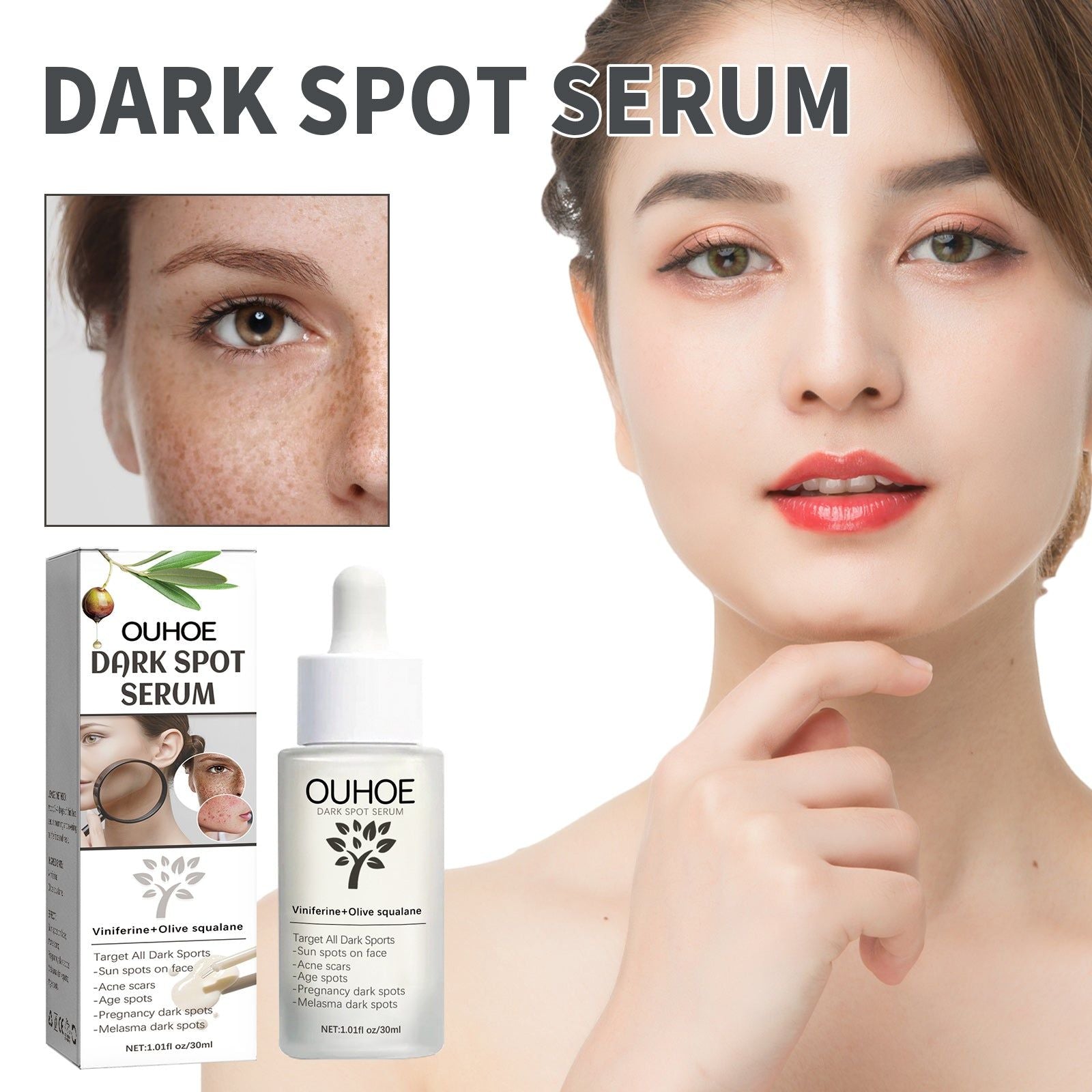 Brighten Skin Serum for Acne, Pimples, and Dark Spots, Hydrating, Anti-Inflammatory ,30ml