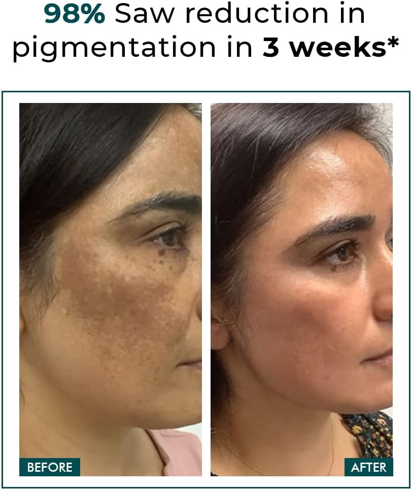 Conscious Chemist Kojic Acid Face Cream | 50g | - Trubiom