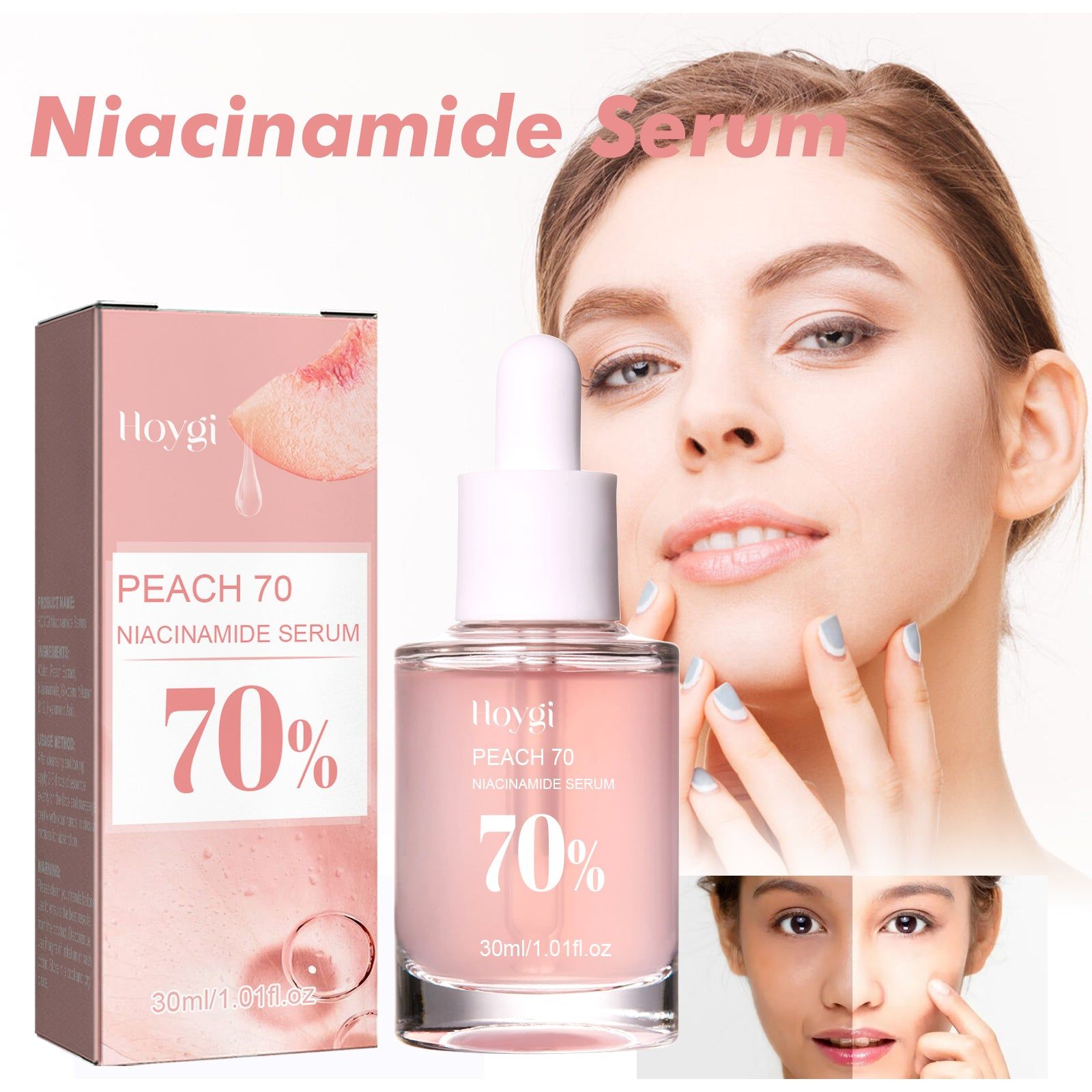 Nicotinamide Serum for Brightening and Rejuvenating Skin, Reduces Pores, Fades Dark Spots ,30ml
