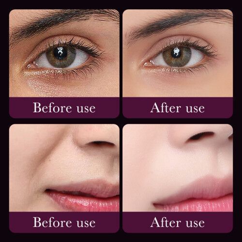 Snail Eye Masks, Collagen Improves Dark Circles - 001-SD93547