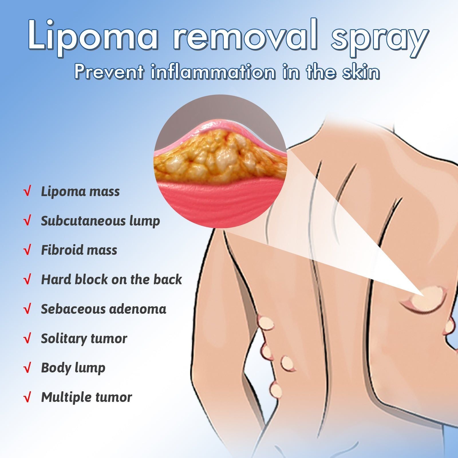 Body Care Spray, Skin Relief, Repair, Tightness & Discomfort, Lipoma Solution ,50ml