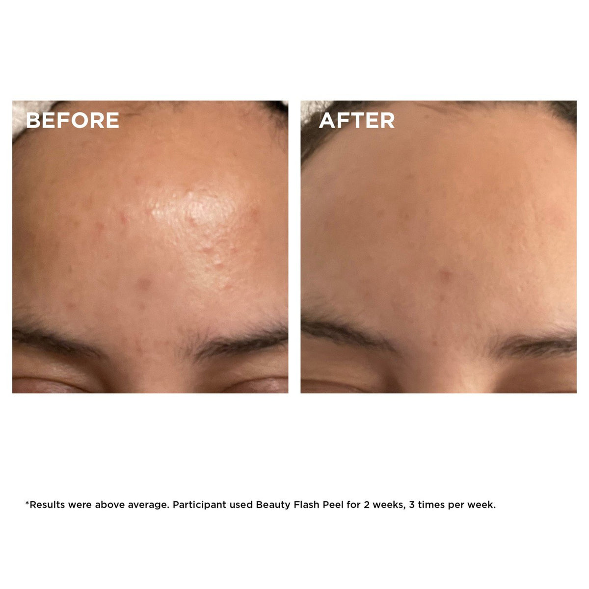 Beauty Flash Peel 50ml