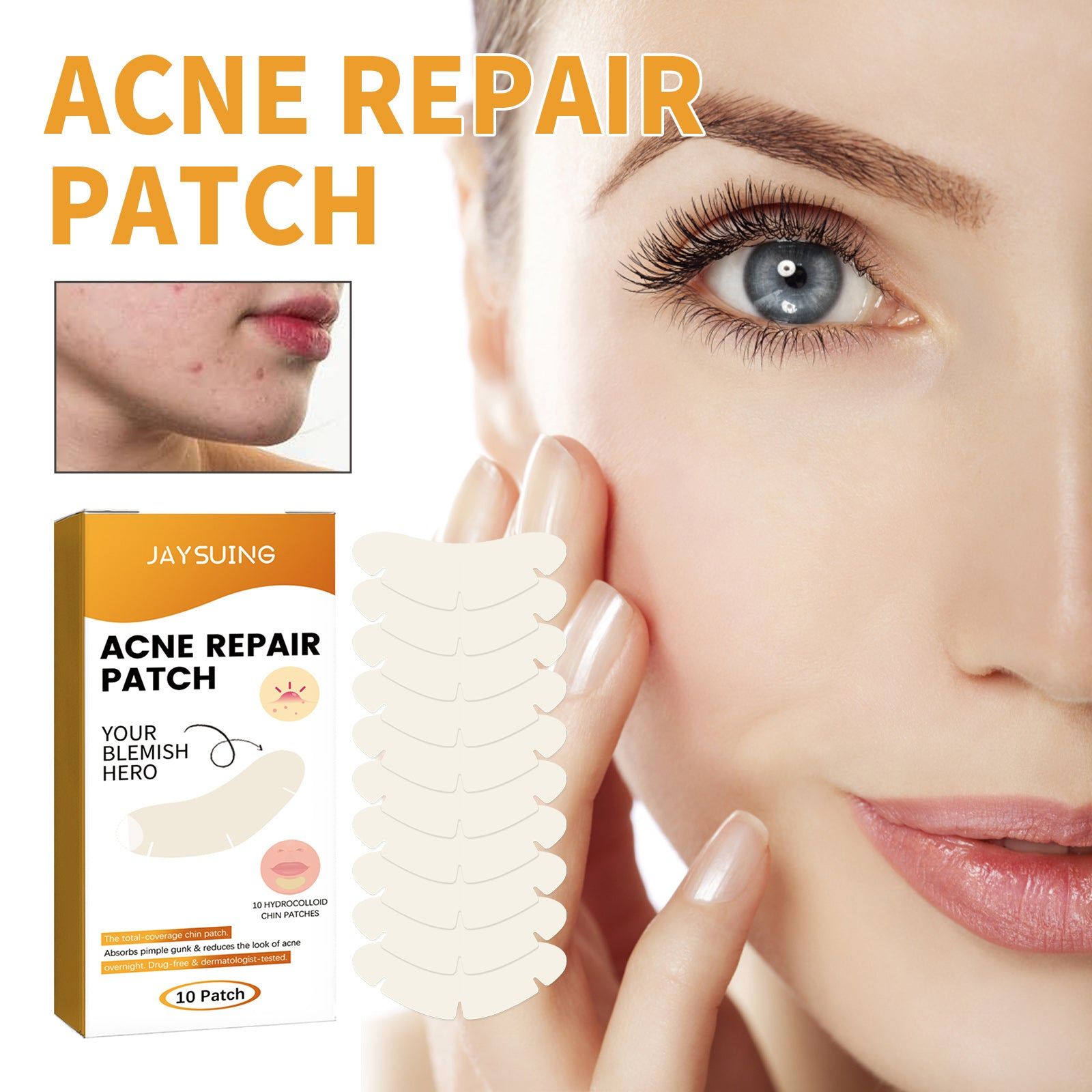 Chin Acne Patch, Smoothing Pimple & Oil Absorbing Hydrocolloidal Mask ,10pcs