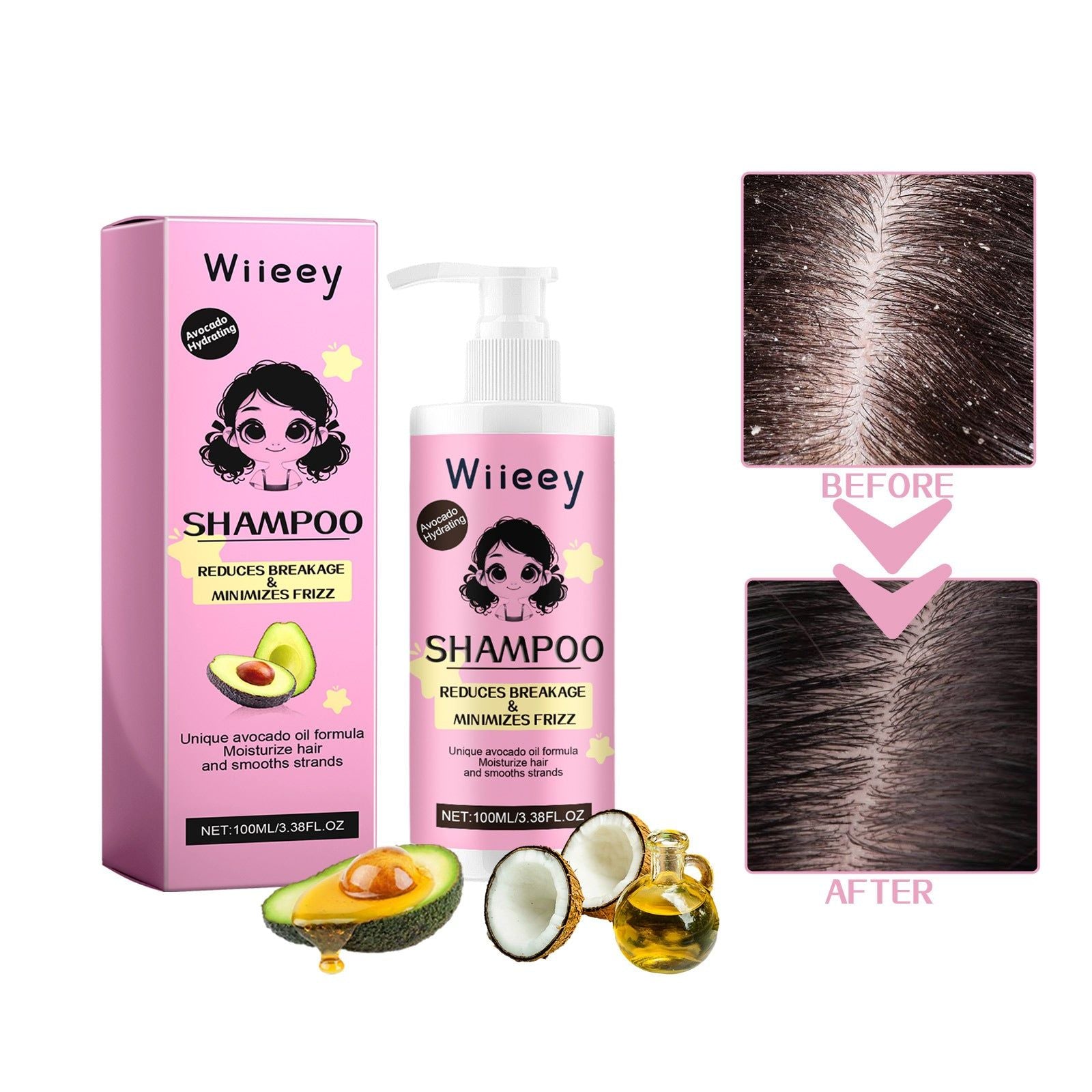 Avocado Hair Shampoo Deep Cleansing Moisturizing Oil Control Long Lasting Fragrance ,100ml