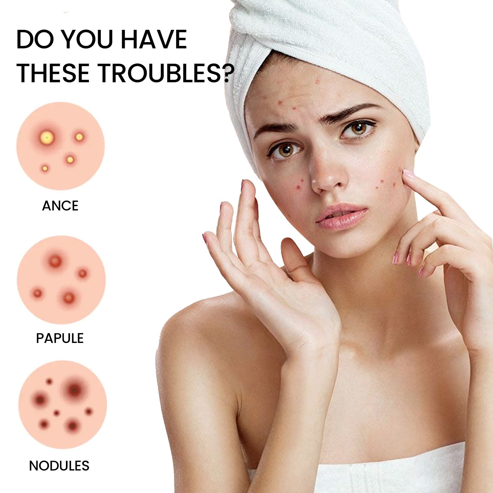 Acne Patch, Reduce Acne Fast, Invisible Hydrocolloid Pimple Cover, Clear Skin ,72pcs