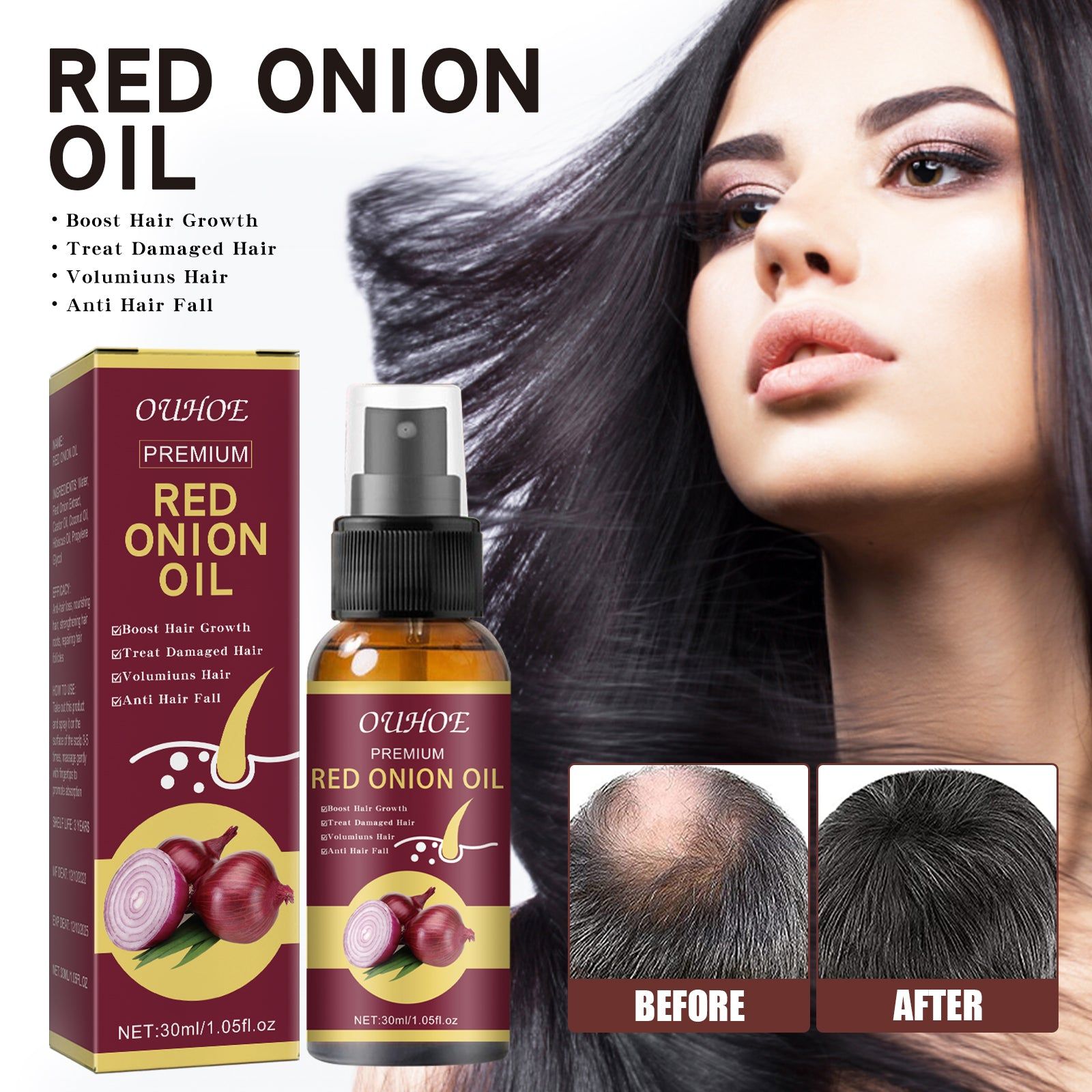 Boost Hair Growth and Fixation, Natural Onion Oil for Stronger, Thicker Hair ,30ml