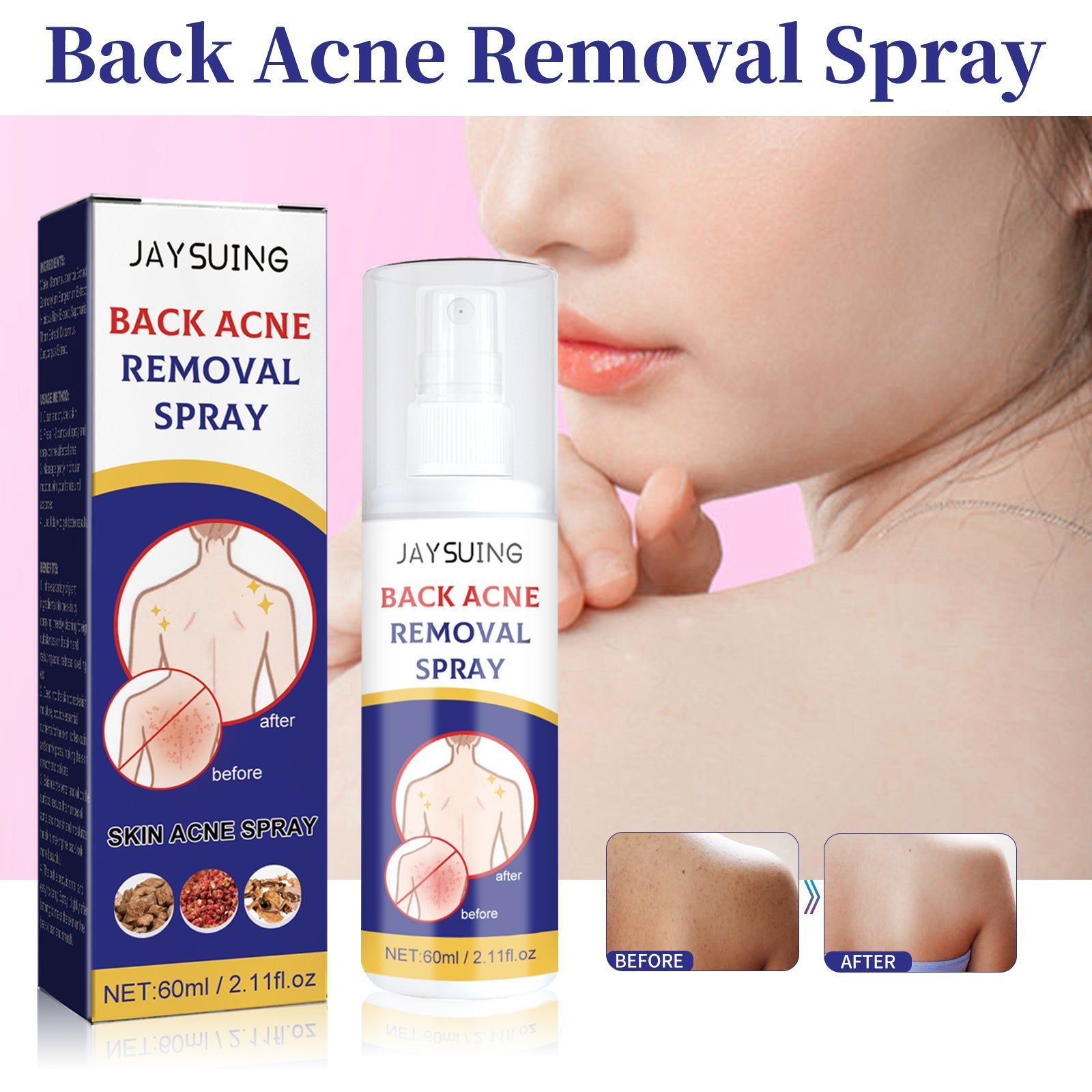 Back Care Spray Fade Acne Marks Soft Skin Moisturizer for Clear Back ,60ml
