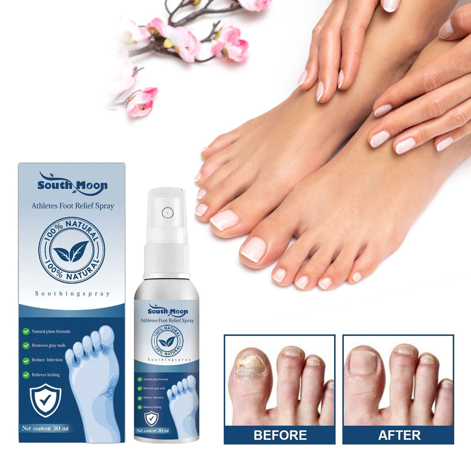 Athletes Foot Relief Spray, Fungal Infection Treatment, Odor & Itch Relief, Moisturizing Foot Care ,30ml
