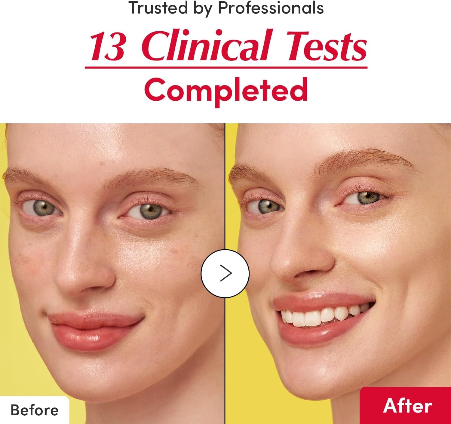 سيروم فيتامين إيكوالبيري المضيء 30 مل