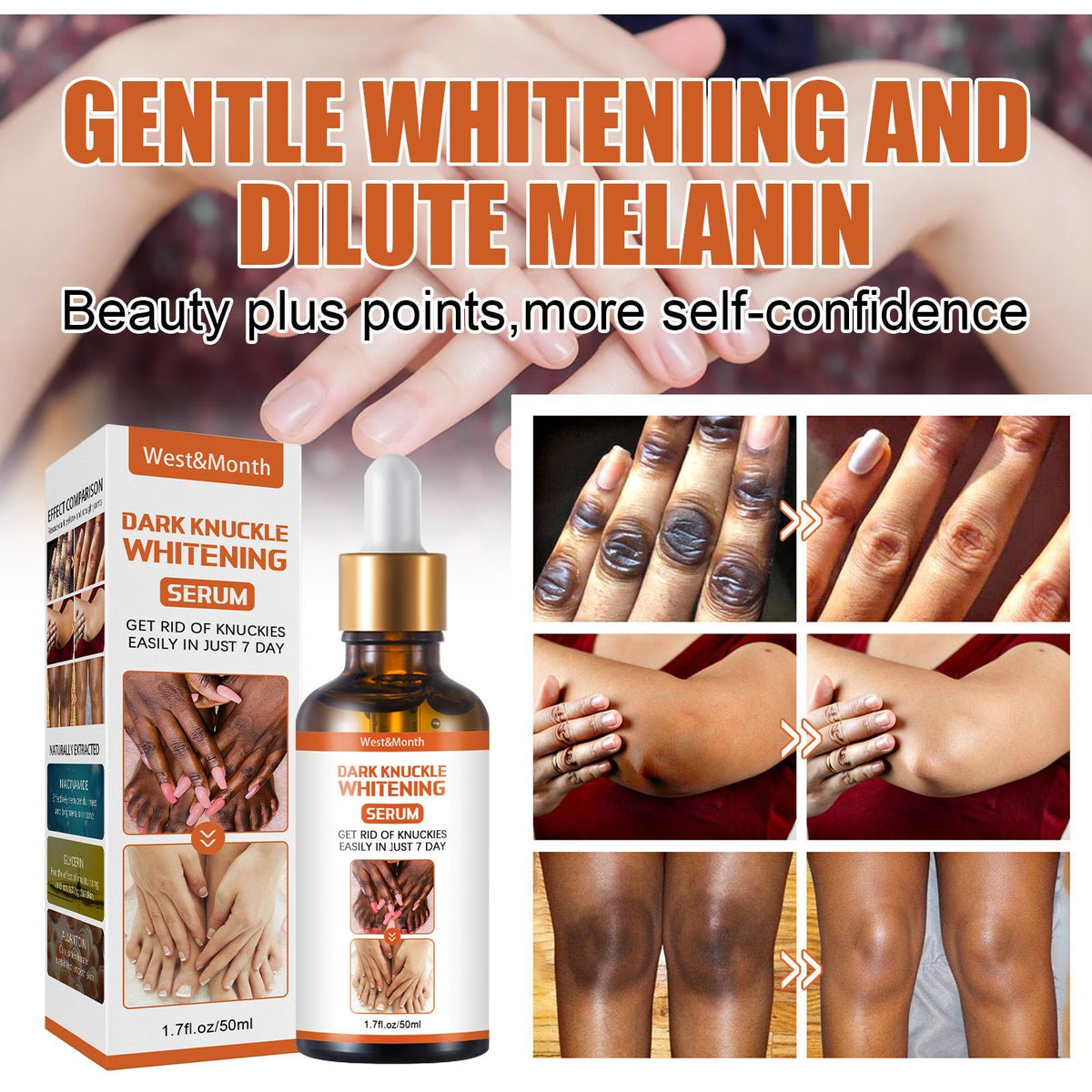 Dark Knuckle Whitening Serum Hand Elbow Knee Brightening Serum Skin Moisturizer