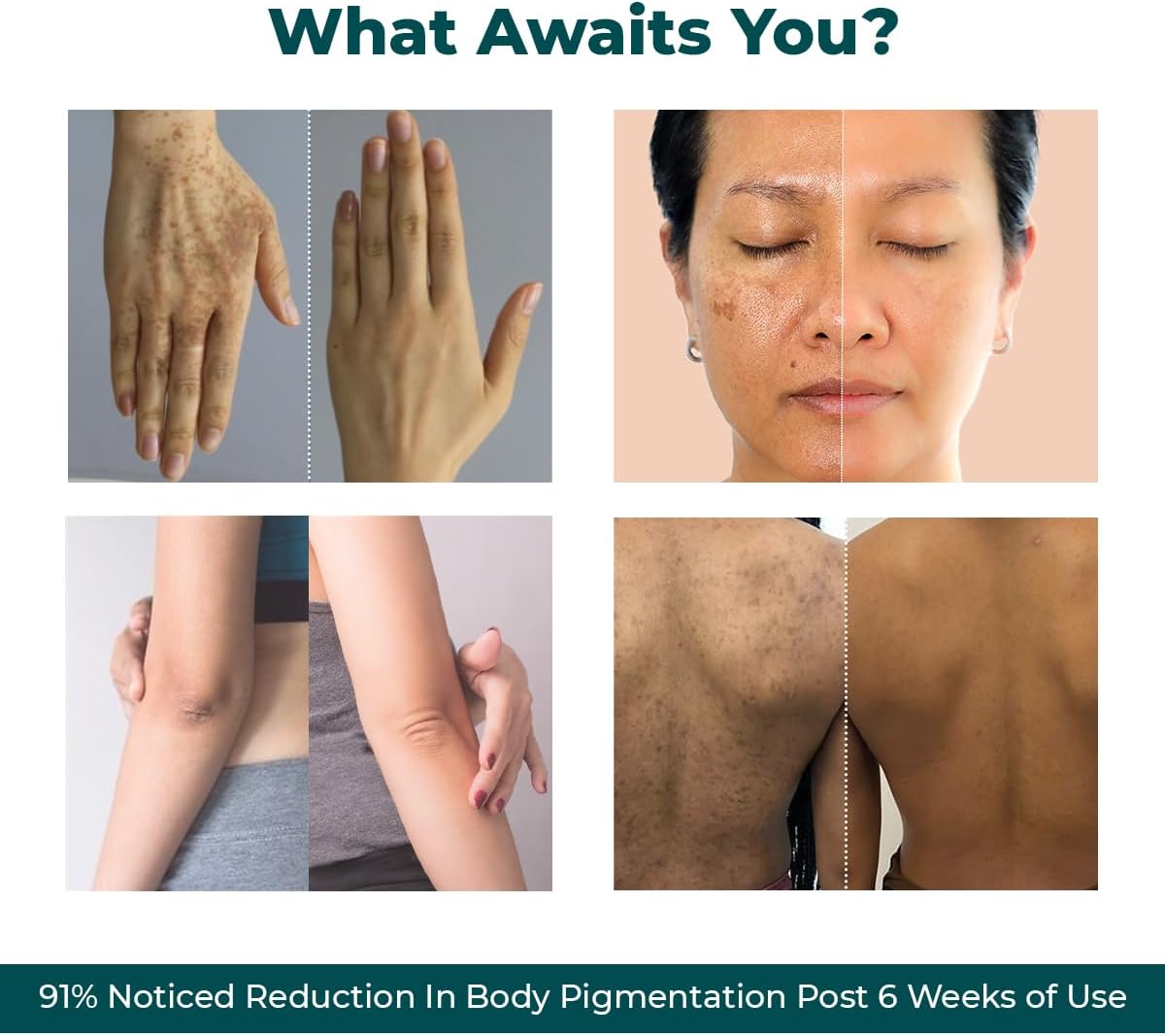 Conscious Chemist Kojic Acid Face Cream | 50g | - Trubiom