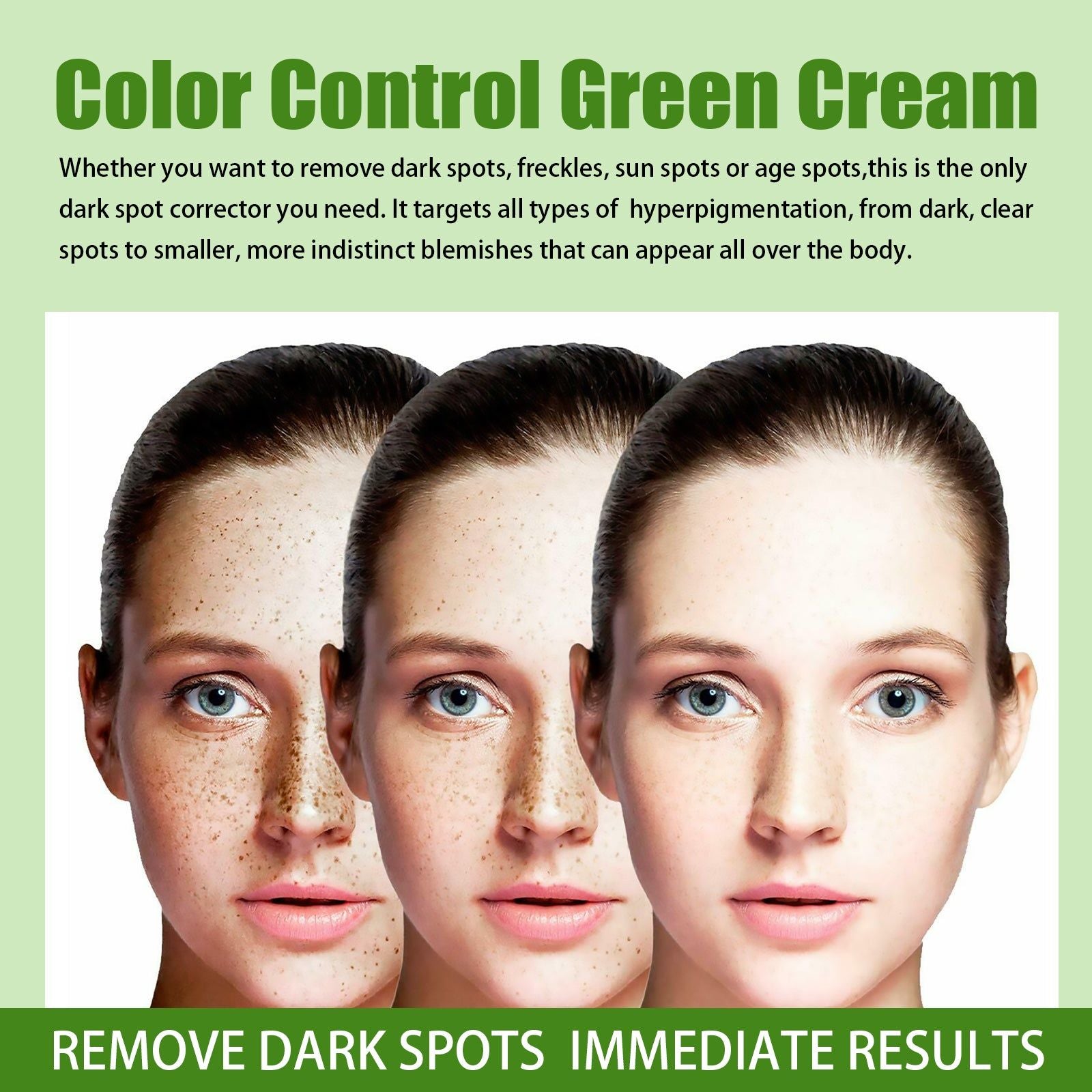 Brightening Skin Cream, Decomposes Melanin, Fades Spots, Nourishing, Hydrating, Elastic ,30g