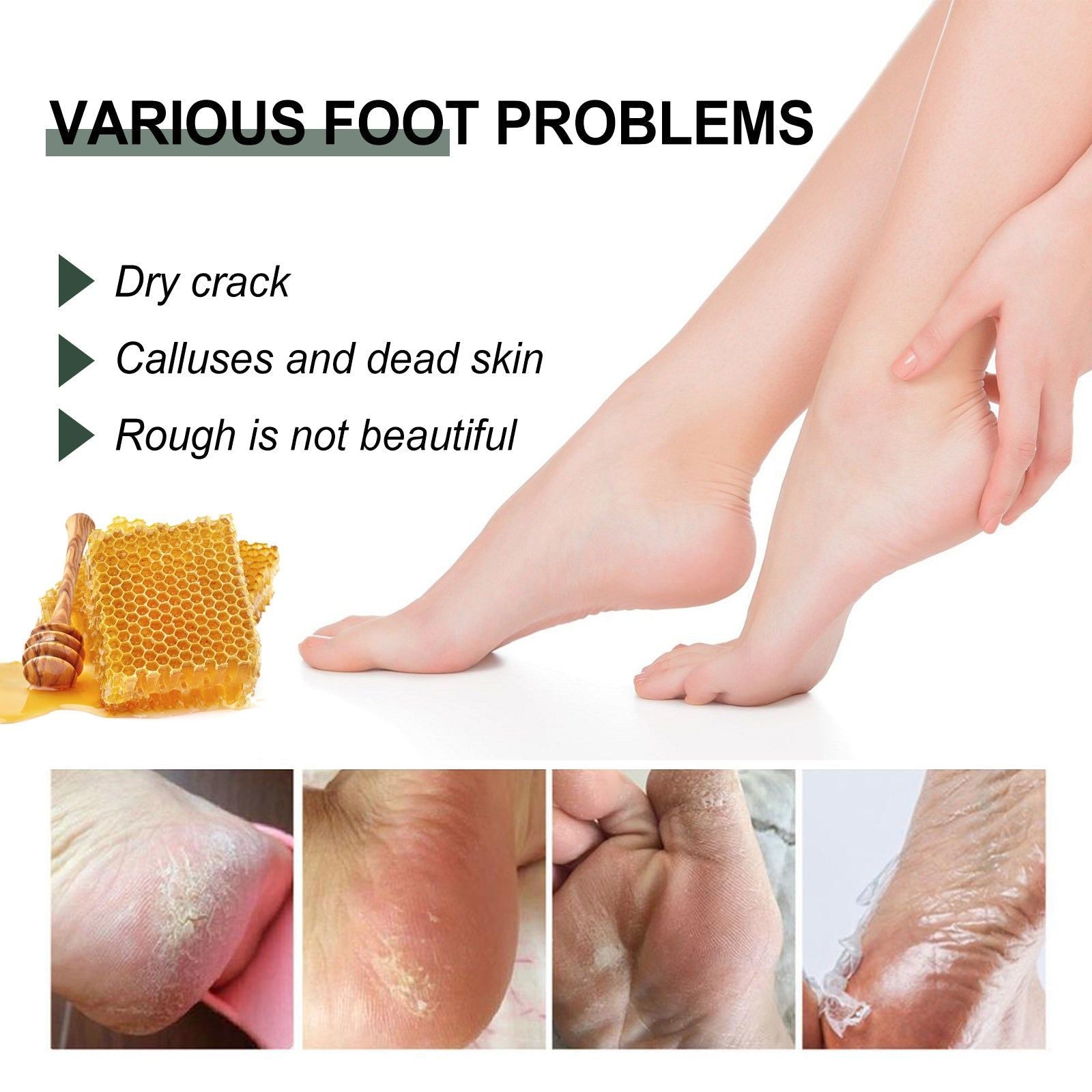 Ultimate Anti-Crack Hand and Foot Cream, Deep Moisturizer for Dry Skin, Repair & Nourish ,30g