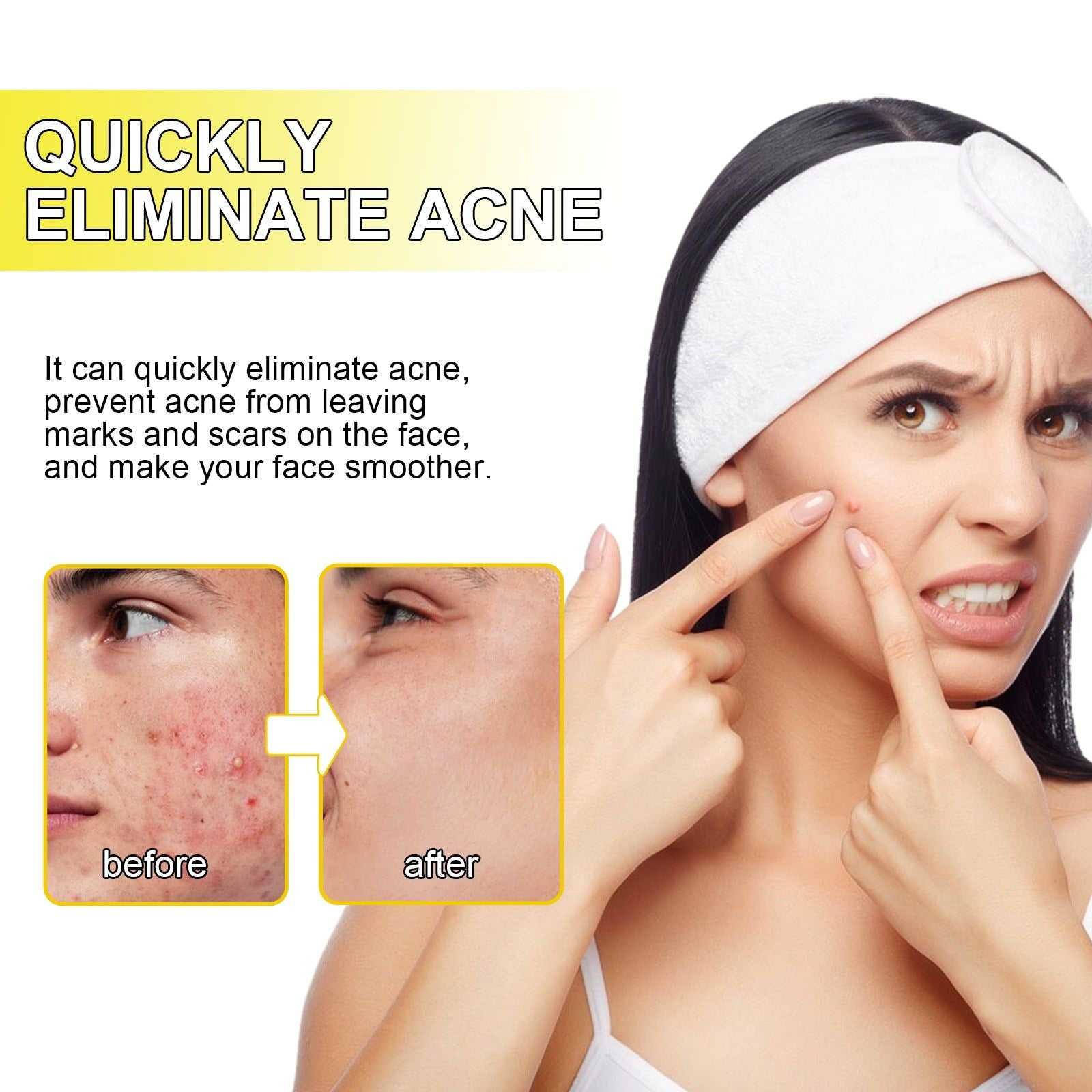 Clear Acne Fast with Tea Tree Hydrocolloid Patches for Facial Cleansing, Pore Detox, and Skin Repair ,20pcs