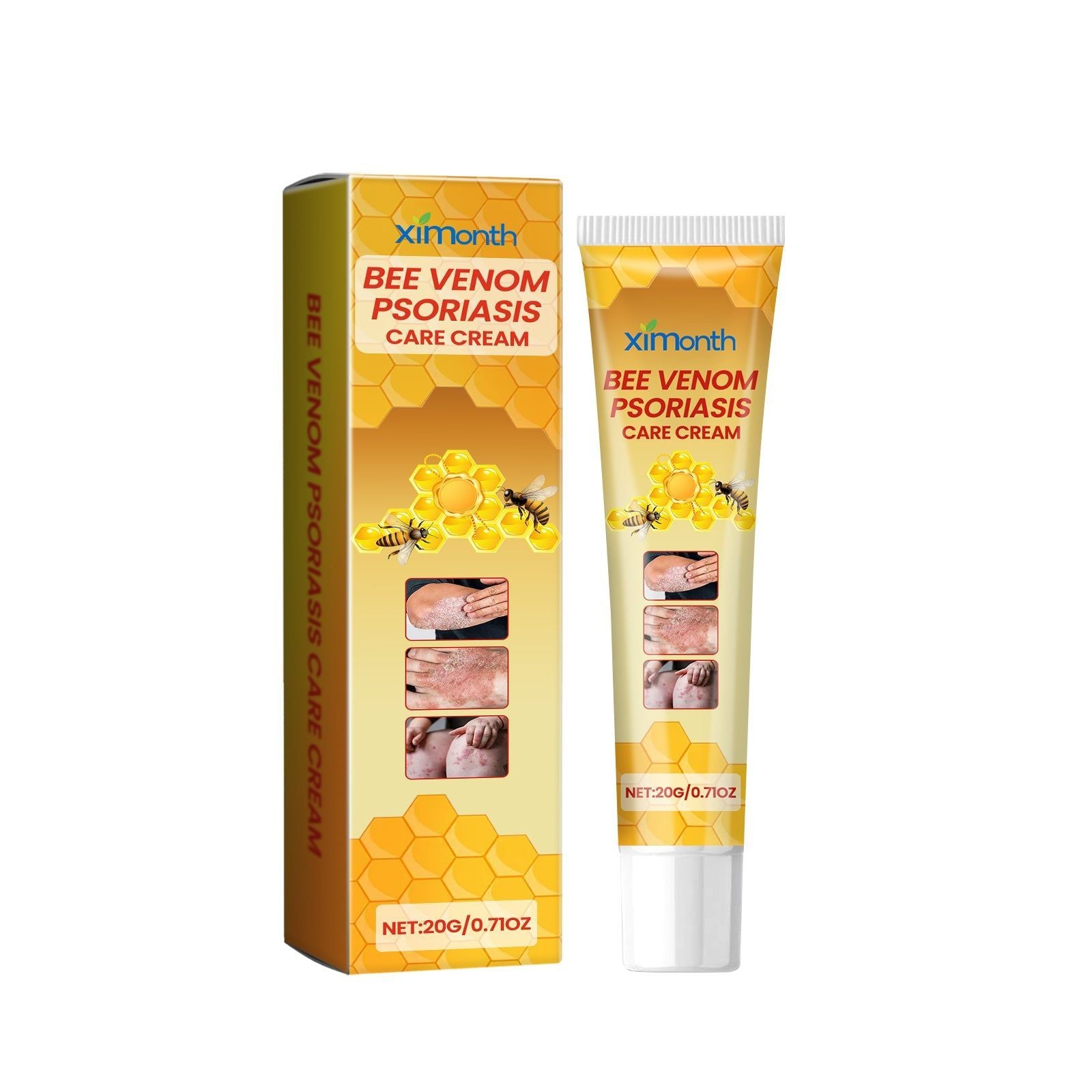Bee-Poison Cowhide Moss Cream for Skin Care, Relieves Redness, Itchiness, Psoriasis ,20g