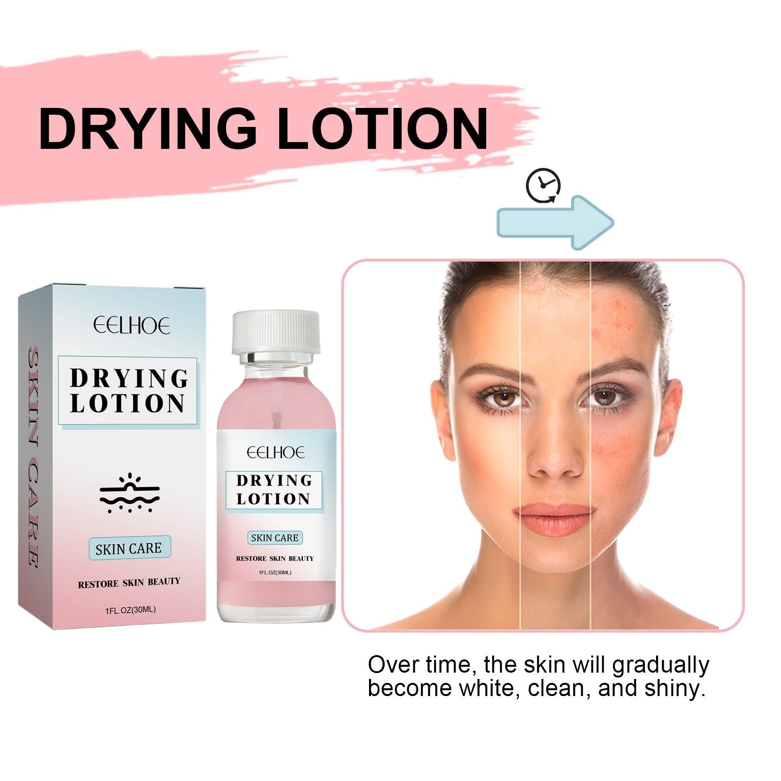 Acne Spot Treatment, Reduce Acne Fast, Clear Skin, Pore Refining, Brightening ,30ml