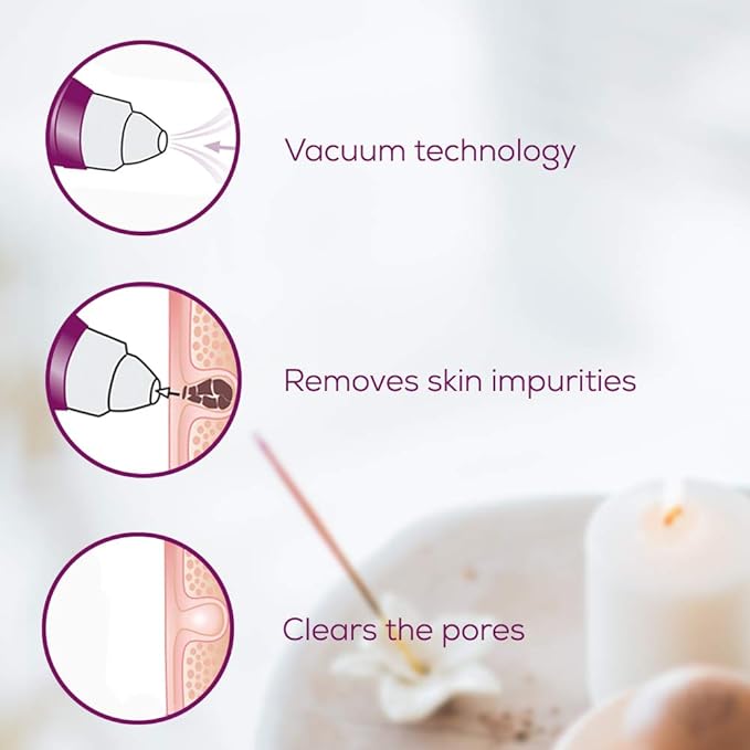 Beurer Power deep pore cleanser | FC41 | Pore Vacuum with 5 Intensity Levels and 3 Attachments for Deep Pore Cleaning Suitable For All Skin Types | Premium Facial cleansing tools