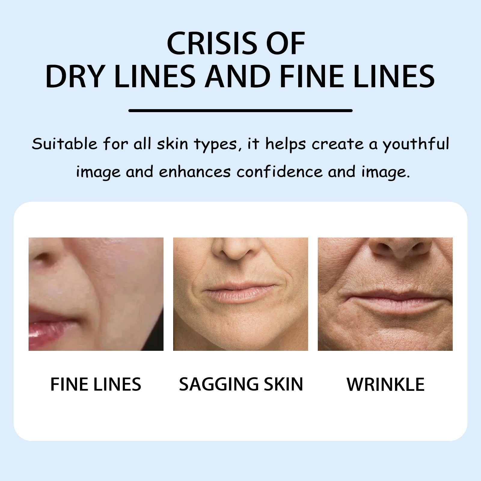 Anti-Wrinkle Nasolabial Patches, Hydrating, Firming, Youthful Skin ,10pairs