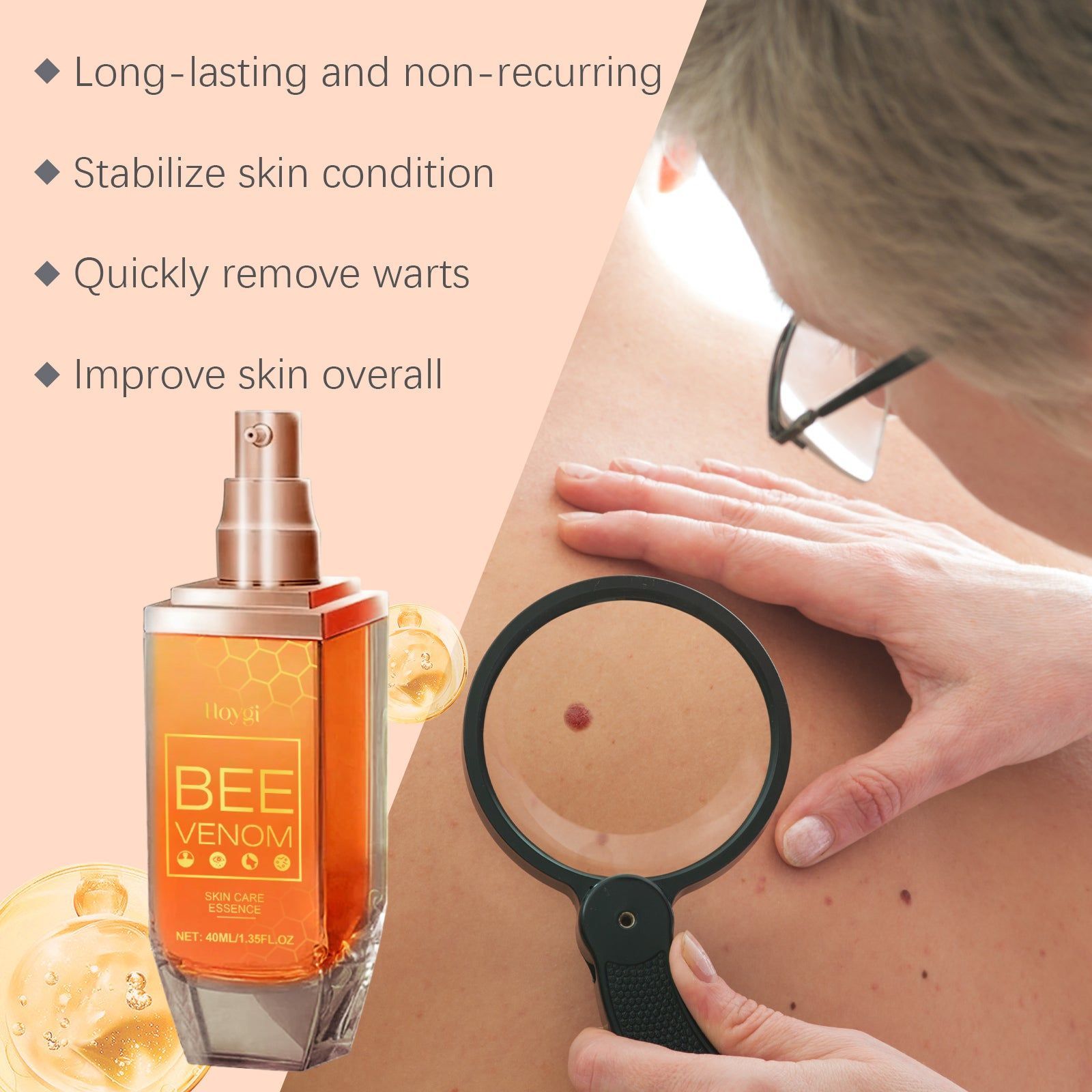 Beespoison Keyu Essence Skin Care, Gentle Wart & Mole Remover, Moisturizing, Repair ,40ml