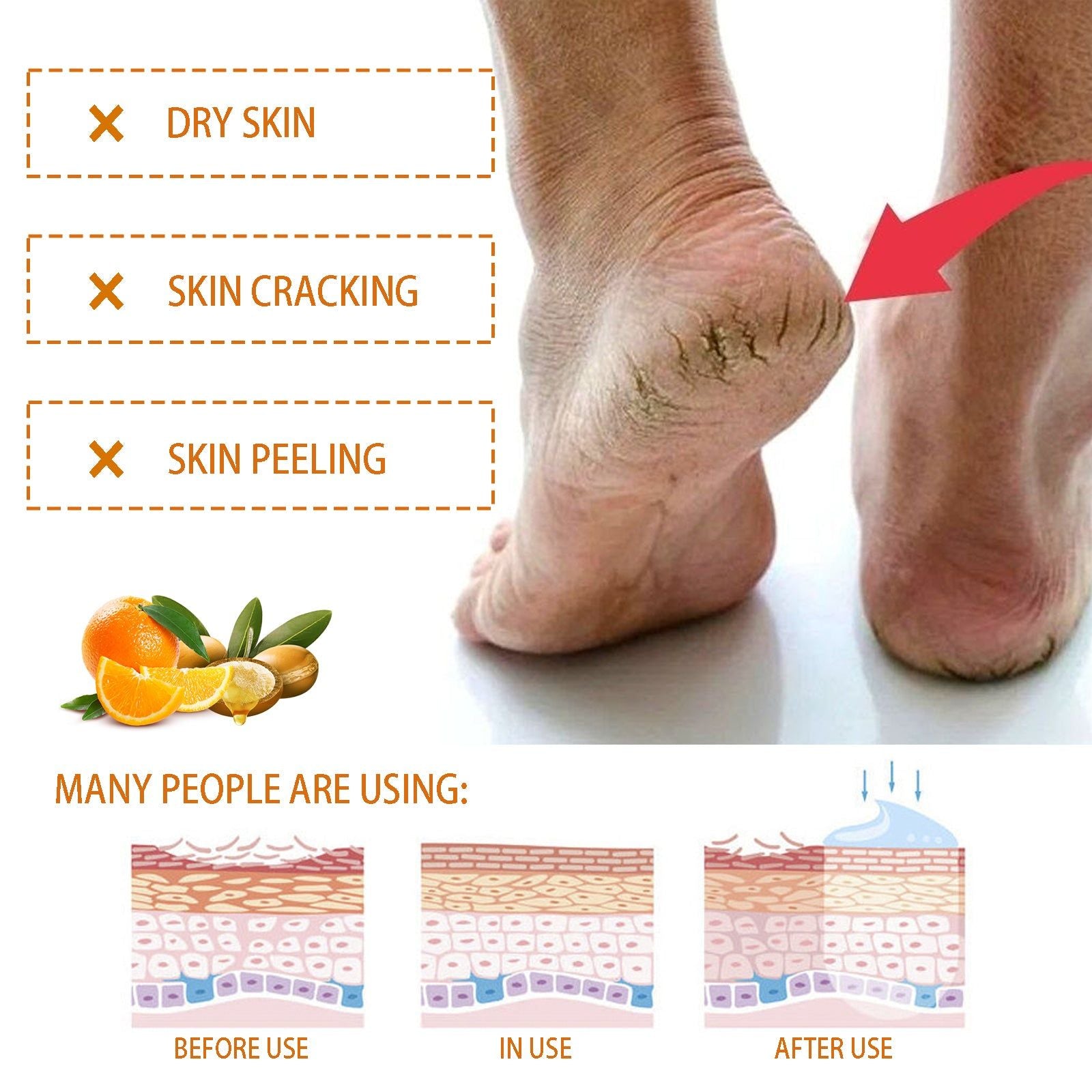 Nourishing Hand and Foot Cream, Moisturize Dry Skin, Anti-Cracking, Hydrating, Repair ,40g