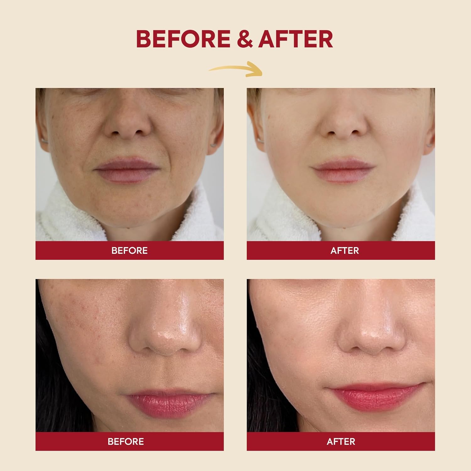 K-SECRET SEOUL 1988 Essence : Snail Mucin 97% + Rice