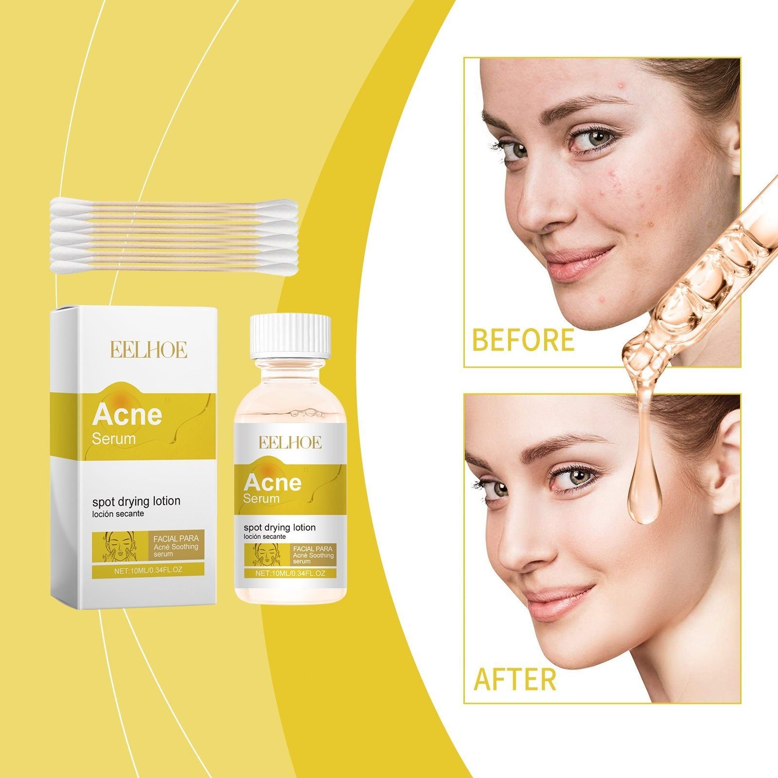 Acne Repair Facial Essence, Clear Pores, Reduce Acne & Comedones, Gentle Skincare ,10ml/box