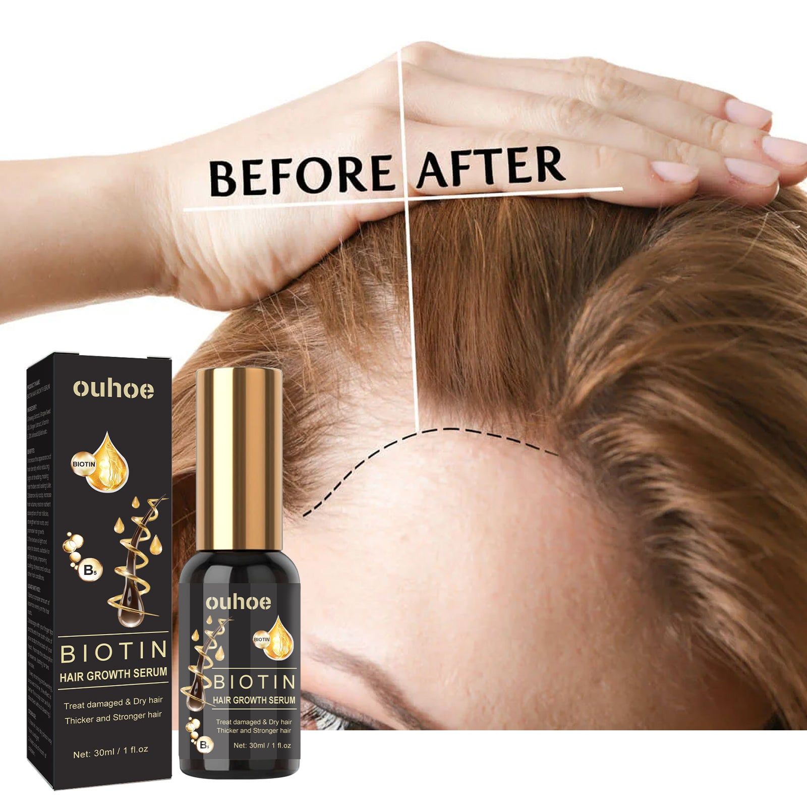 Biotin Hair Serum for Thick Hair, Hair Growth, Moisturizing Treatment, Strong Roots ,30ml