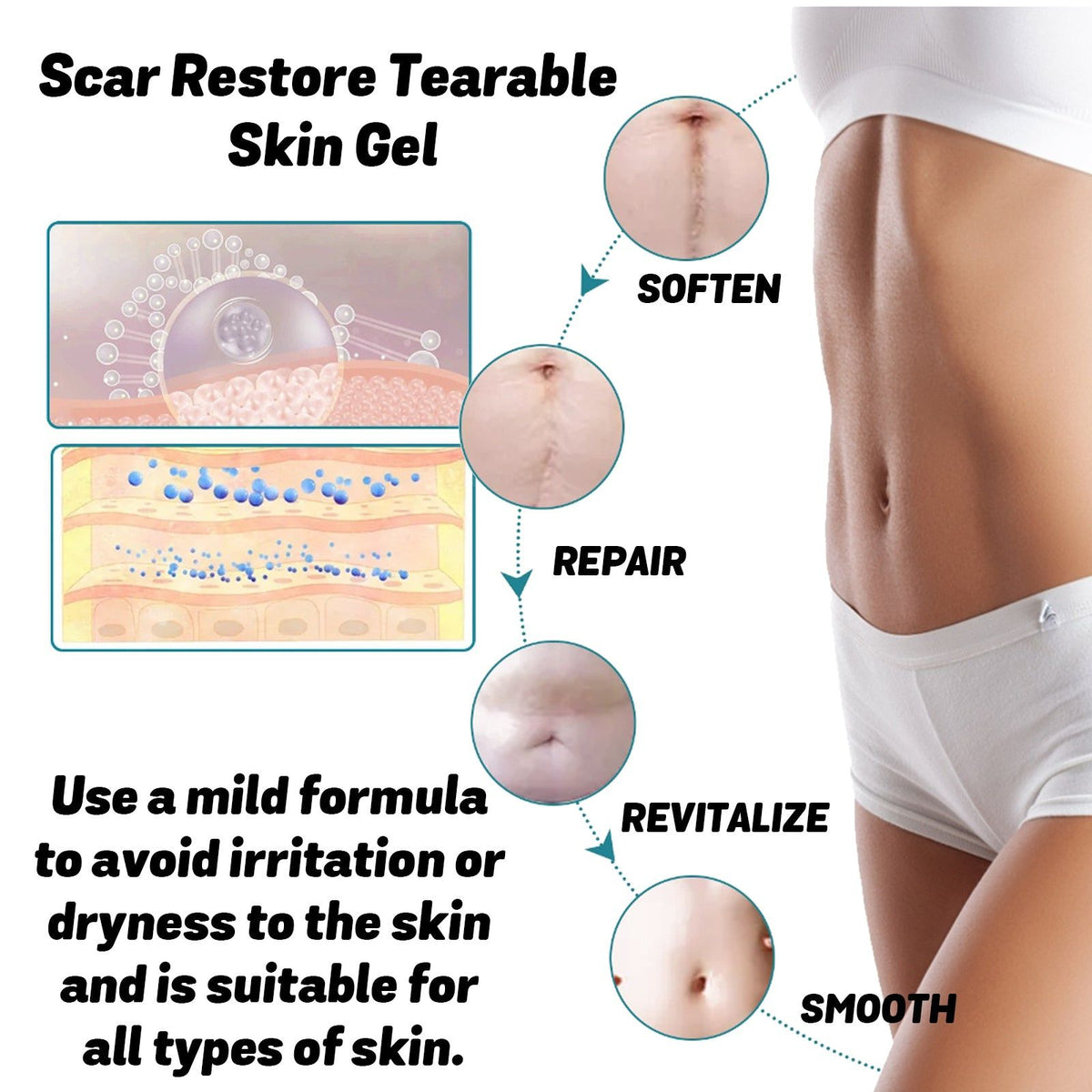 Moisturize Scars Fast, Repair Skin, Fade Scar Gel, Gentle, Non-Greasy, Smooth Skin ,20g