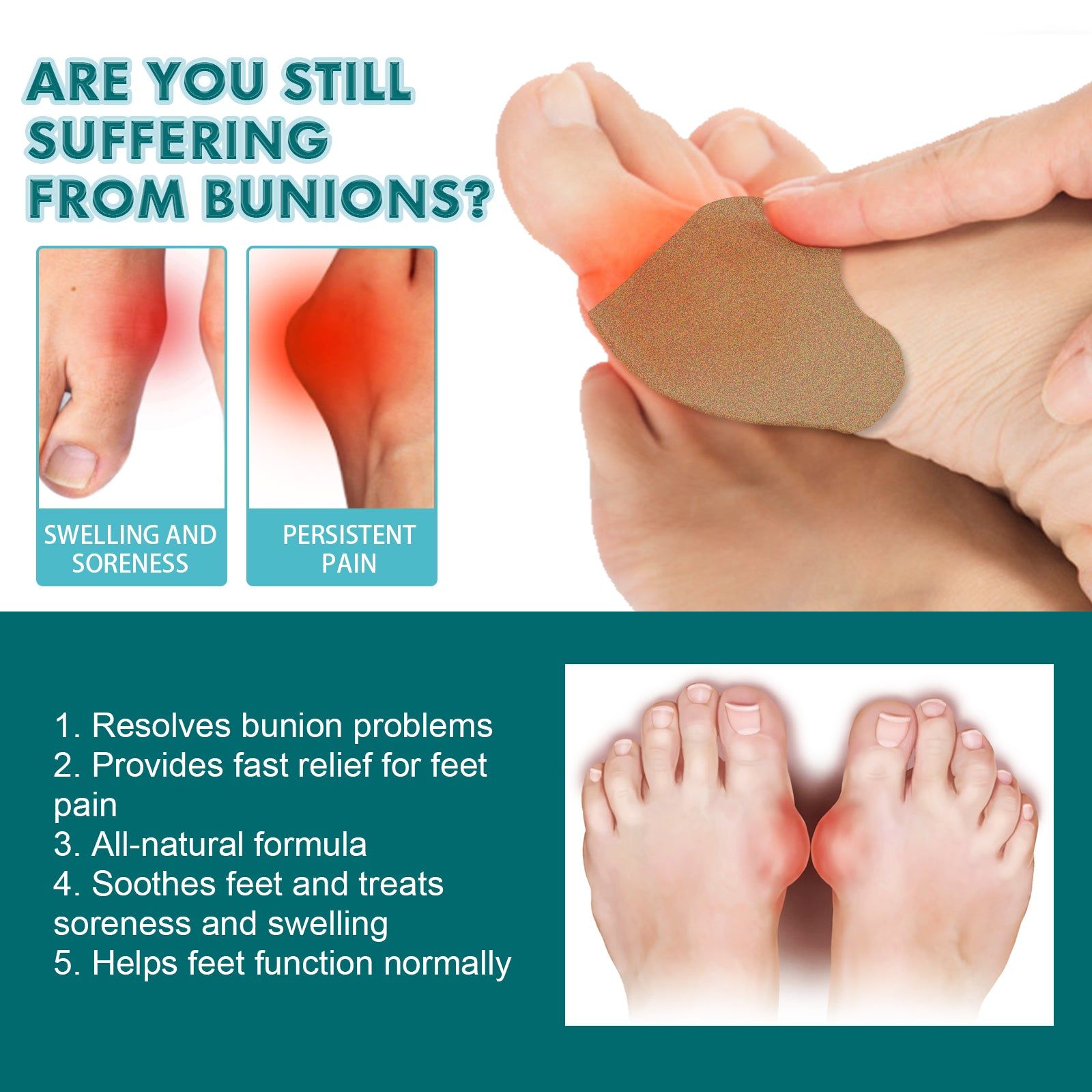 Bunion Patch Relieve Pain and Swelling, Herbal Toe Corrector, Fast Relief ,6pcs