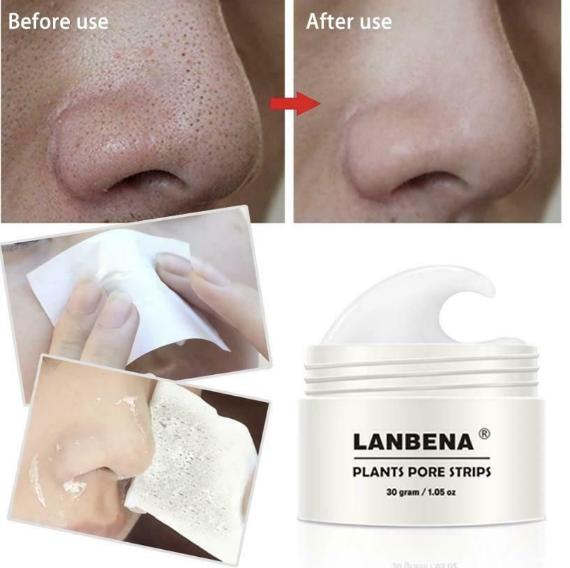 Nose Plants Pore Strips Blackhead Remover Nose Acne Treatment Peel Off Mud Mask