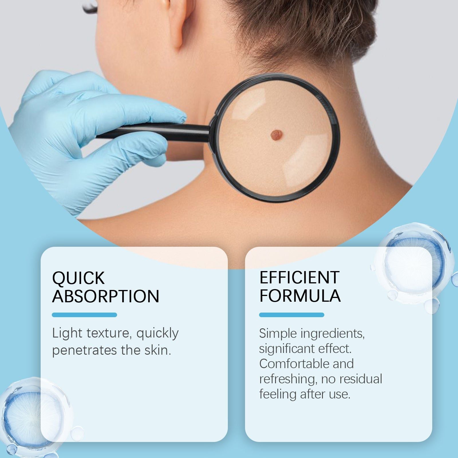 Keyu Liquid for Skin Repair, Moisturizing, Moles & Skin Care, Fast Absorption ,30ml