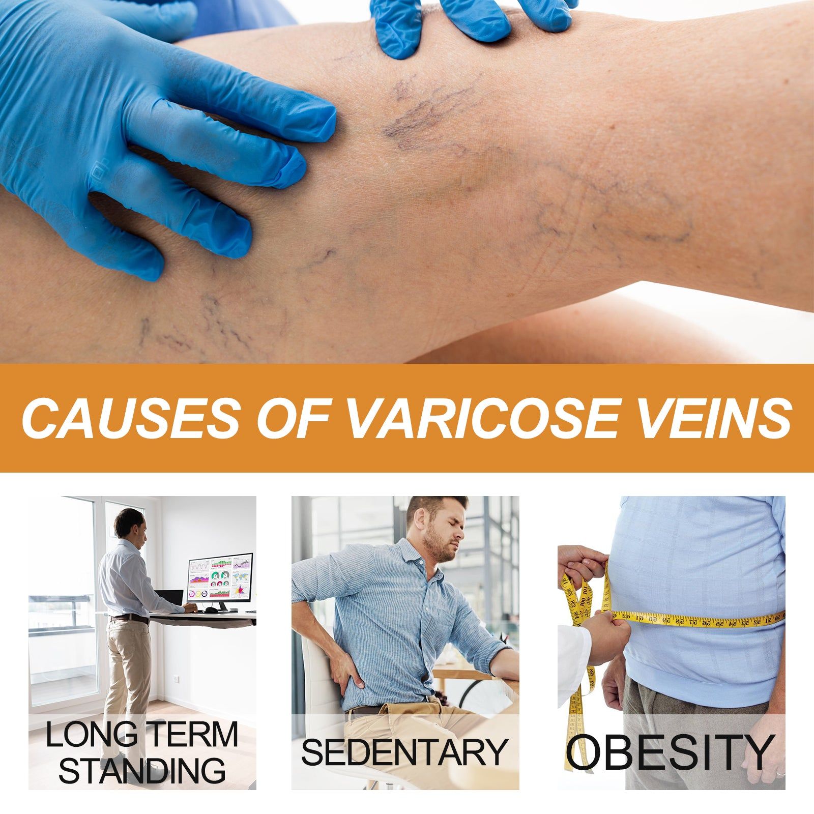 Vein Treatment Cream Relieves Soreness Swelling Moisturizes Legs ,30g